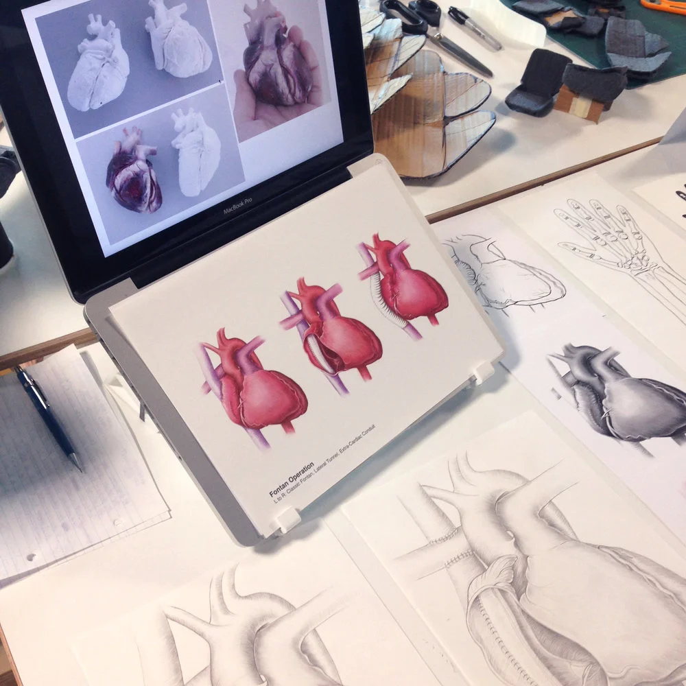 Illustrations of the heart (showing the Fontan procedure) as part of an honours project looking into the effective design of medical illustrations for different users in the hospital.
