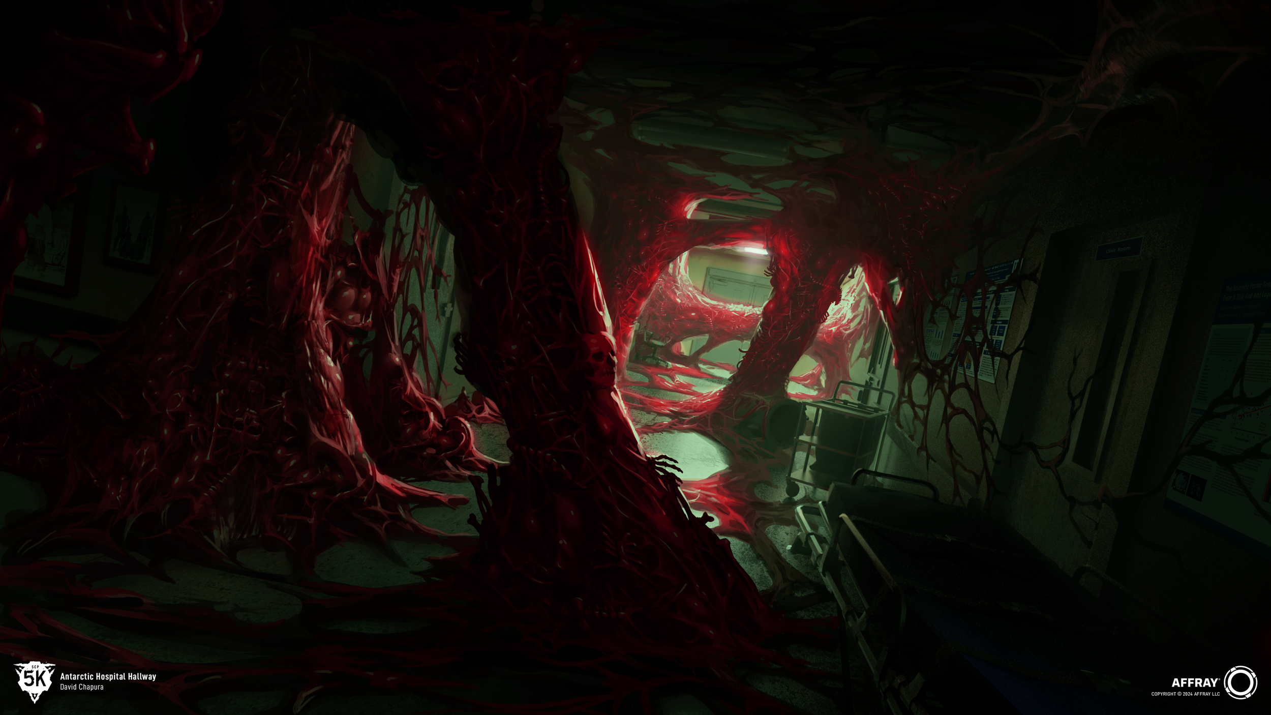 AntarcticHospitalHallway_Chapura_Illustration_01.png