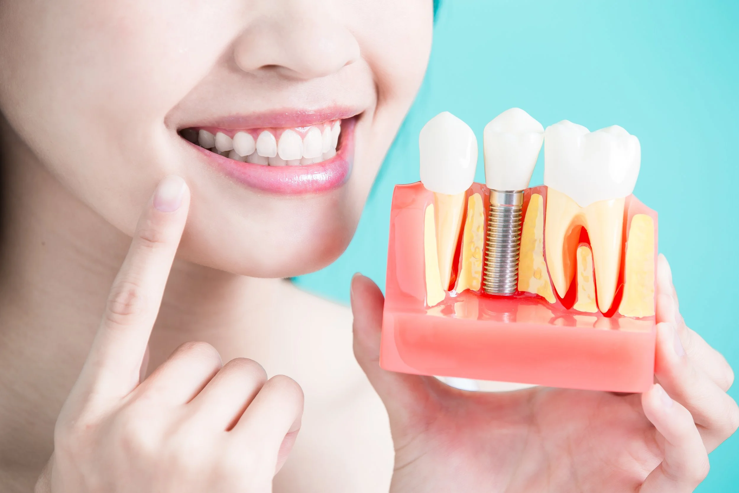 The future of dental implants