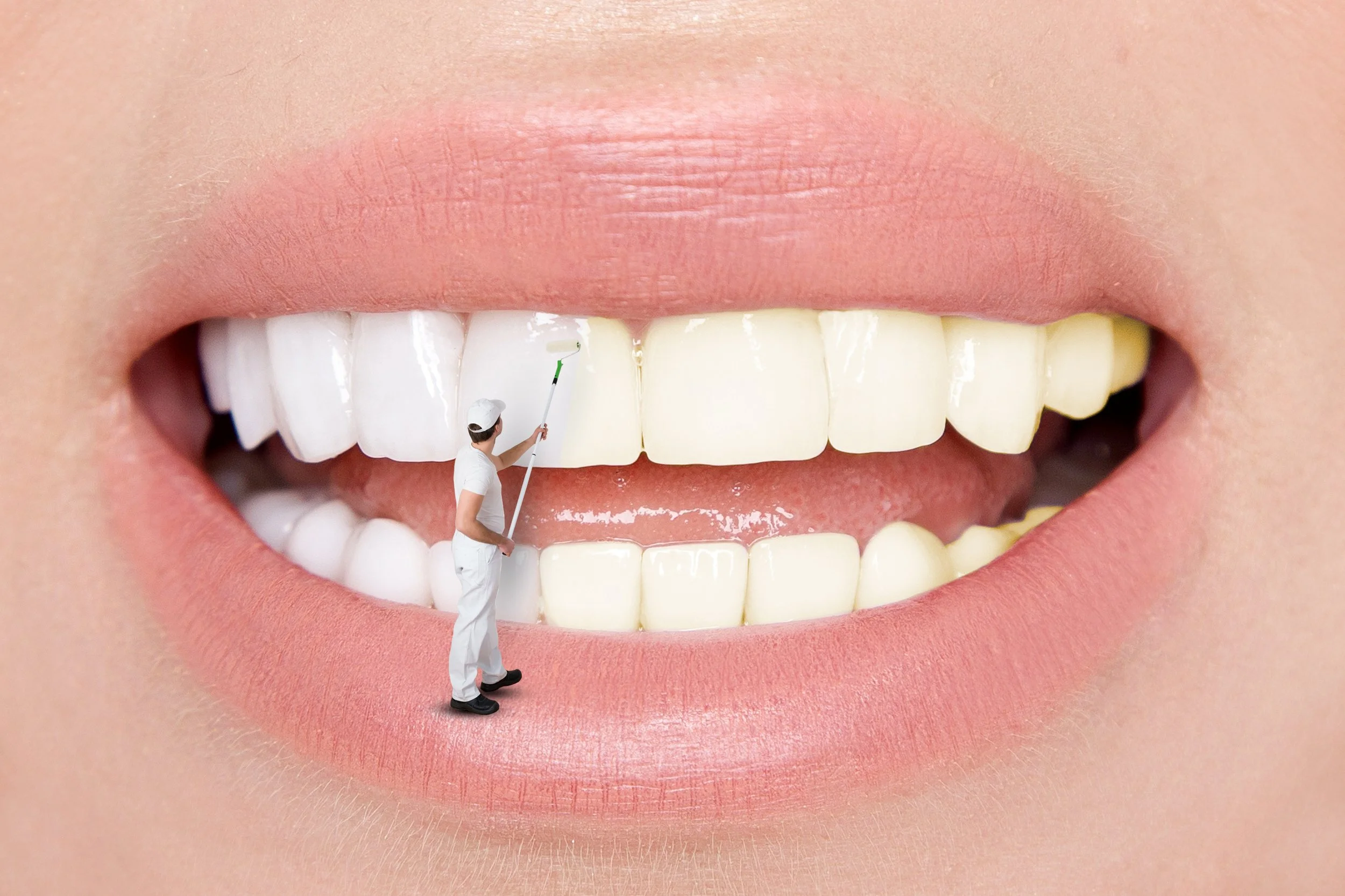 The science behind teeth whitening