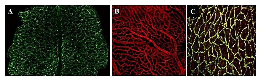Figure 2: In vivo analysis of vascular patterning and juction formation using mouse genetic models. A) Hind brain B) Yolk sac C) En face aorta showing endothelial cell adhesion molecules.