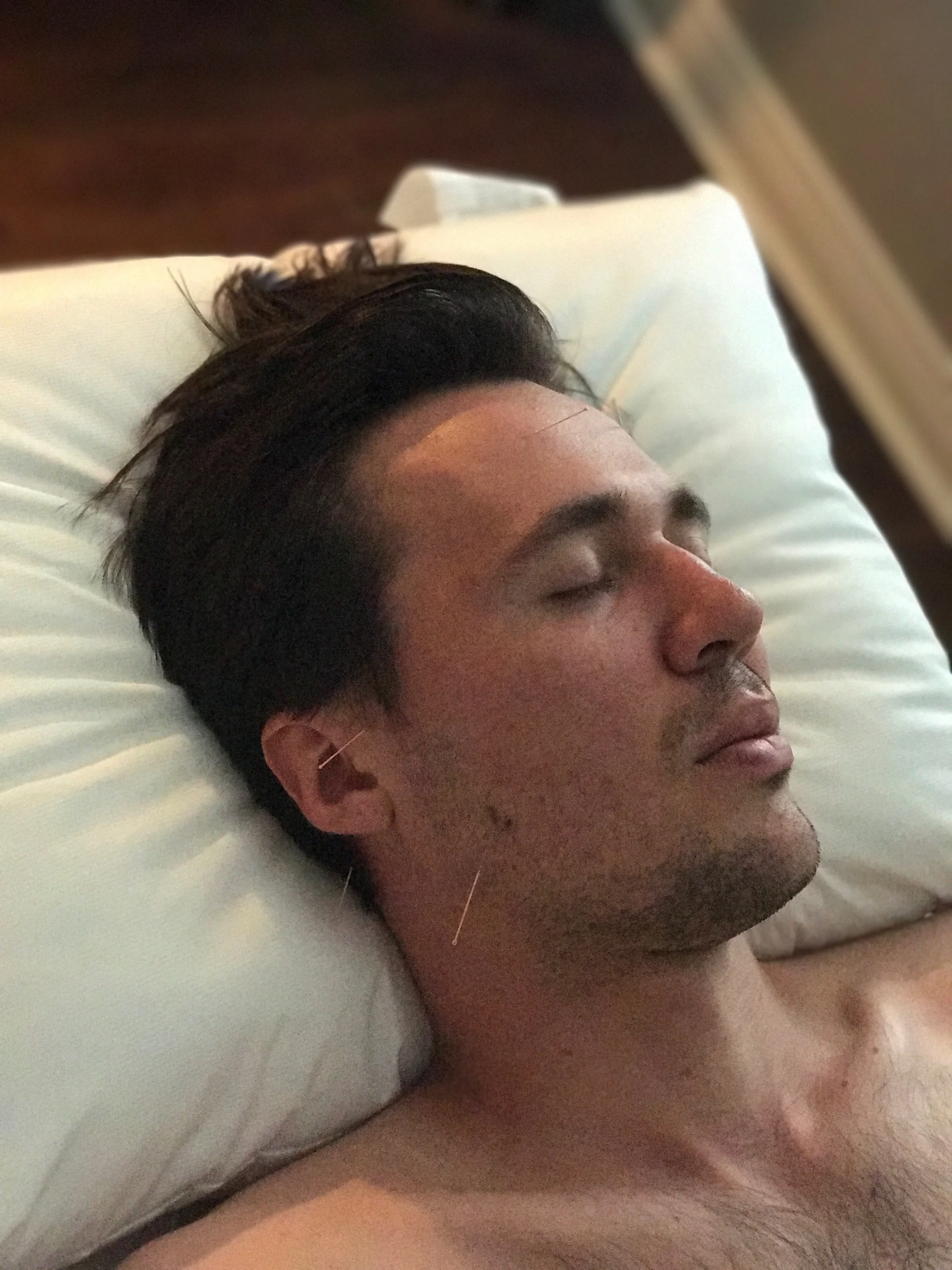 Acupuncture Vancouver - Alla Ozerova - 1.JPG