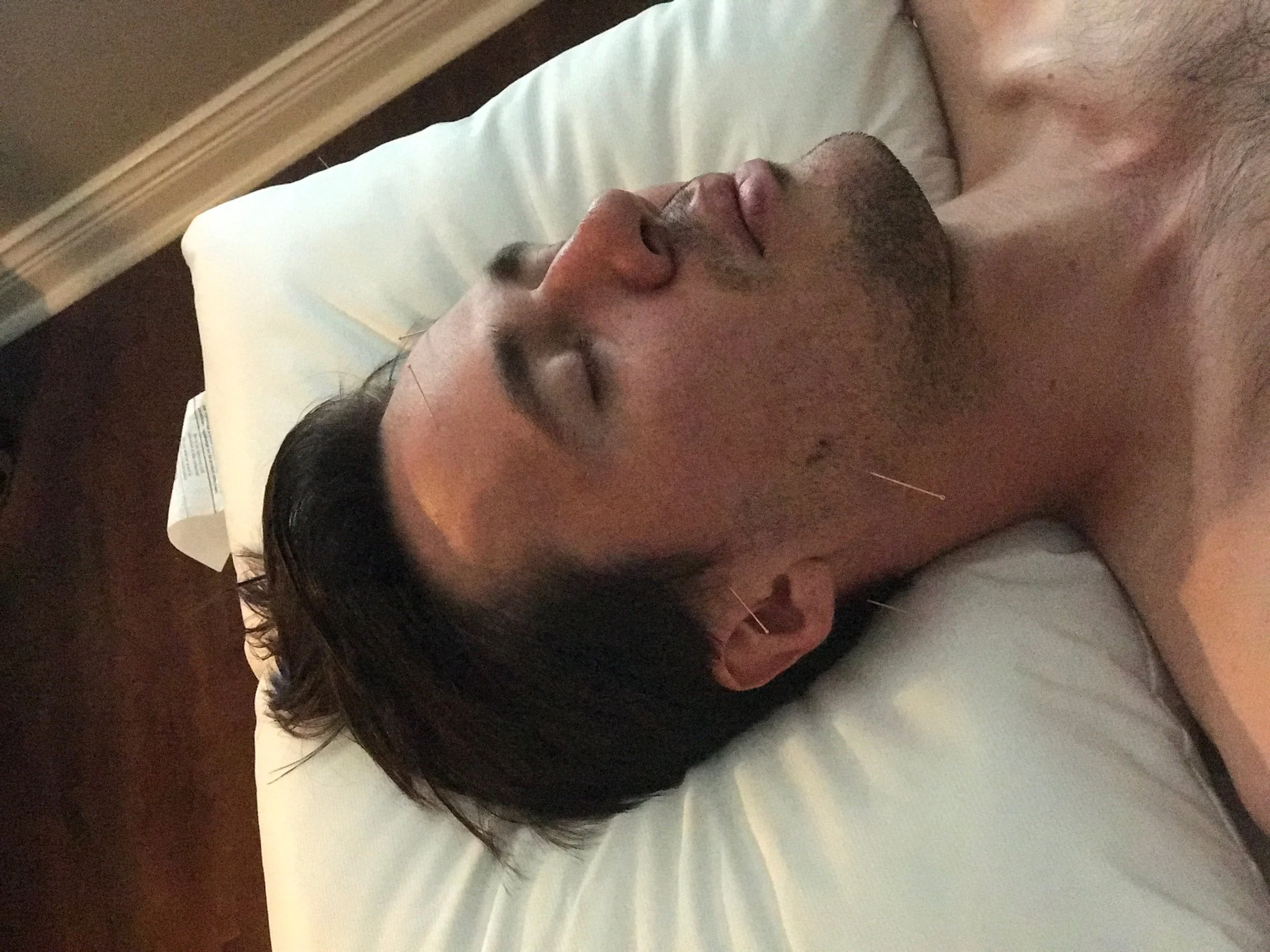 Acupuncture Vancouver - Alla Ozerova - 2.JPG