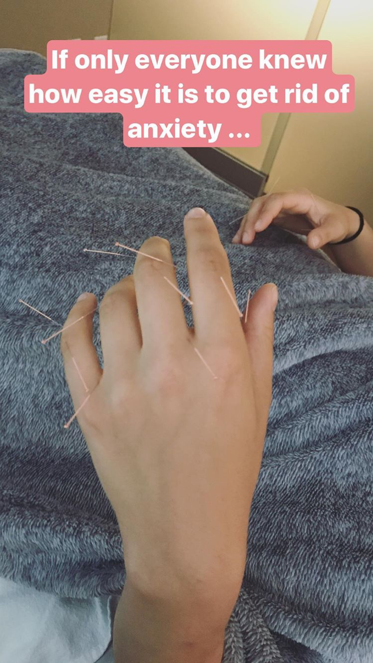 Acupuncture Vancouver - Alla Ozerova - 4.PNG