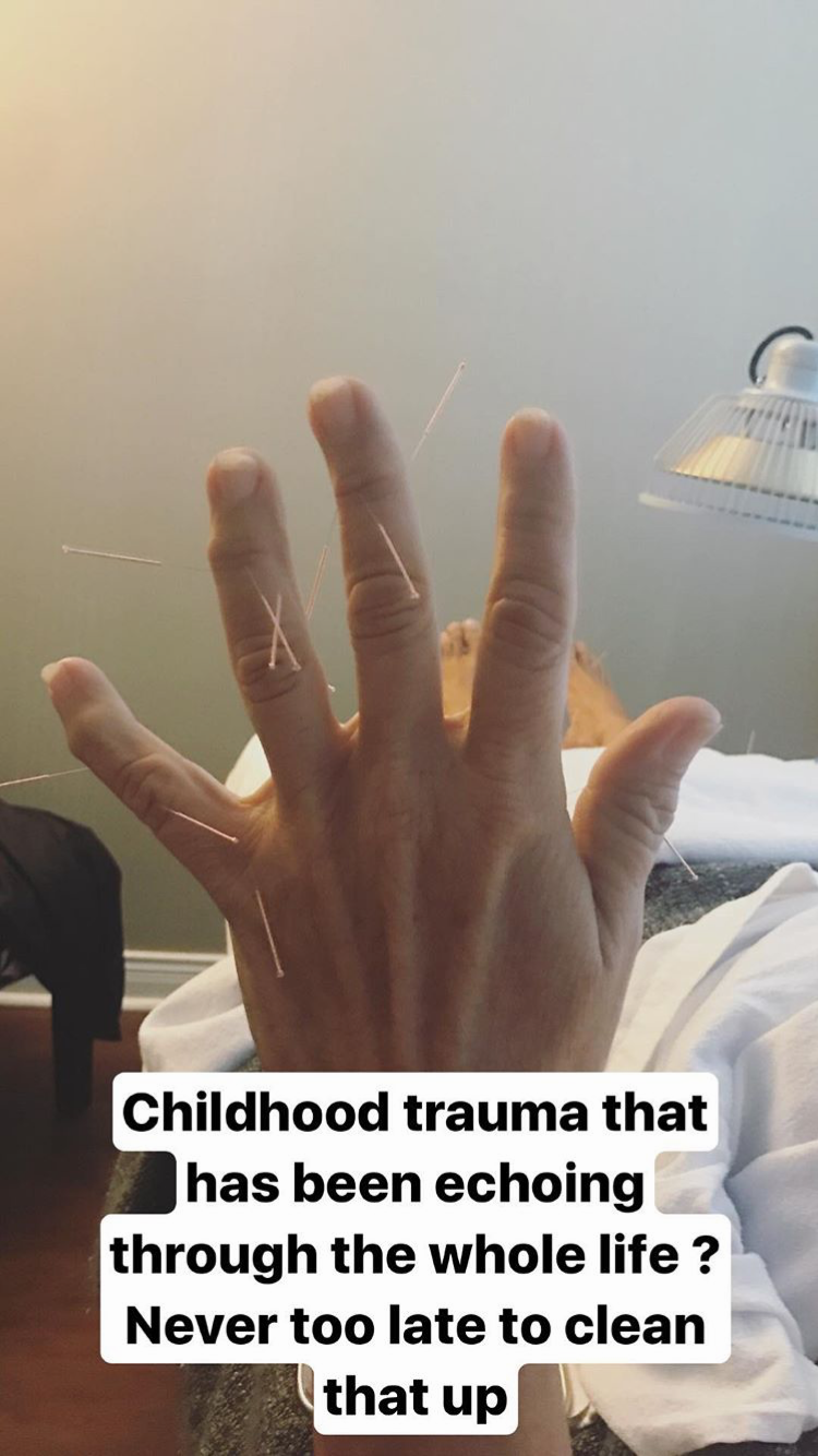 Acupuncture Vancouver - Alla Ozerova - 10.PNG