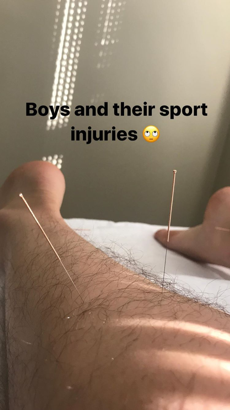 Acupuncture Vancouver - Alla Ozerova - 11.PNG