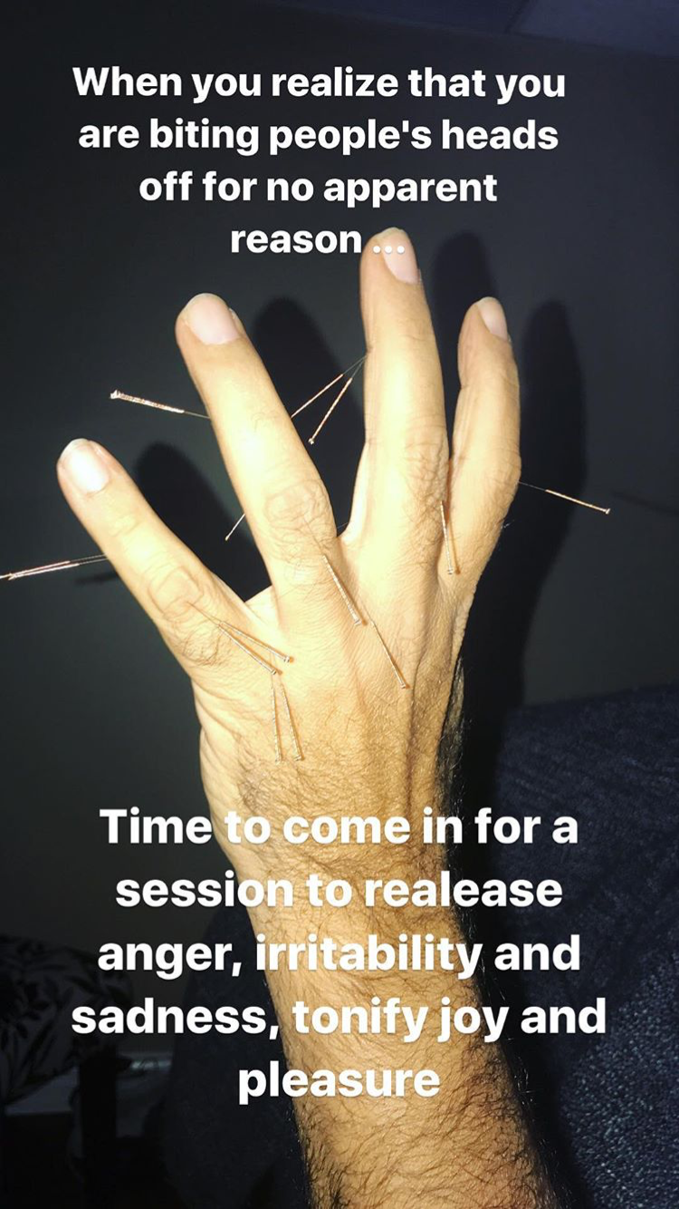Acupuncture Vancouver - Alla Ozerova - 12.PNG