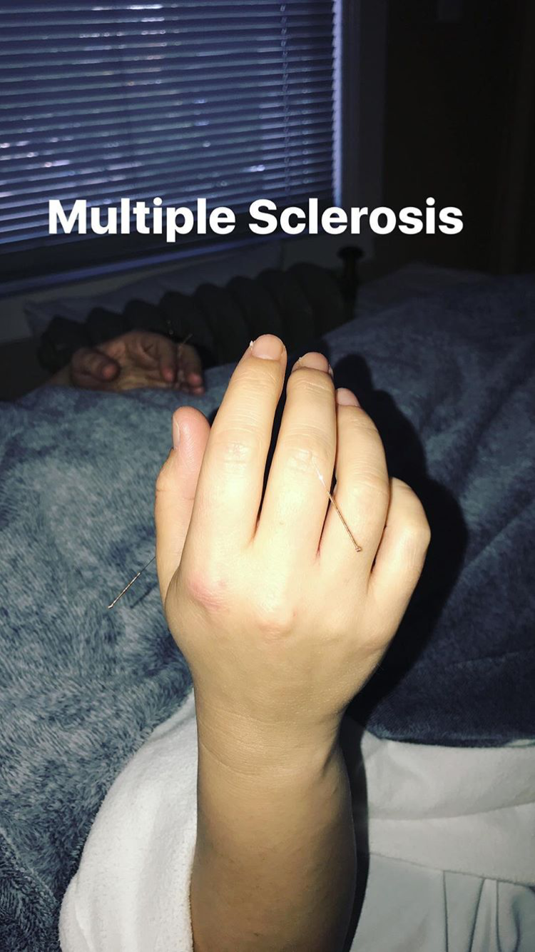 Acupuncture Vancouver - Alla Ozerova - 16.PNG