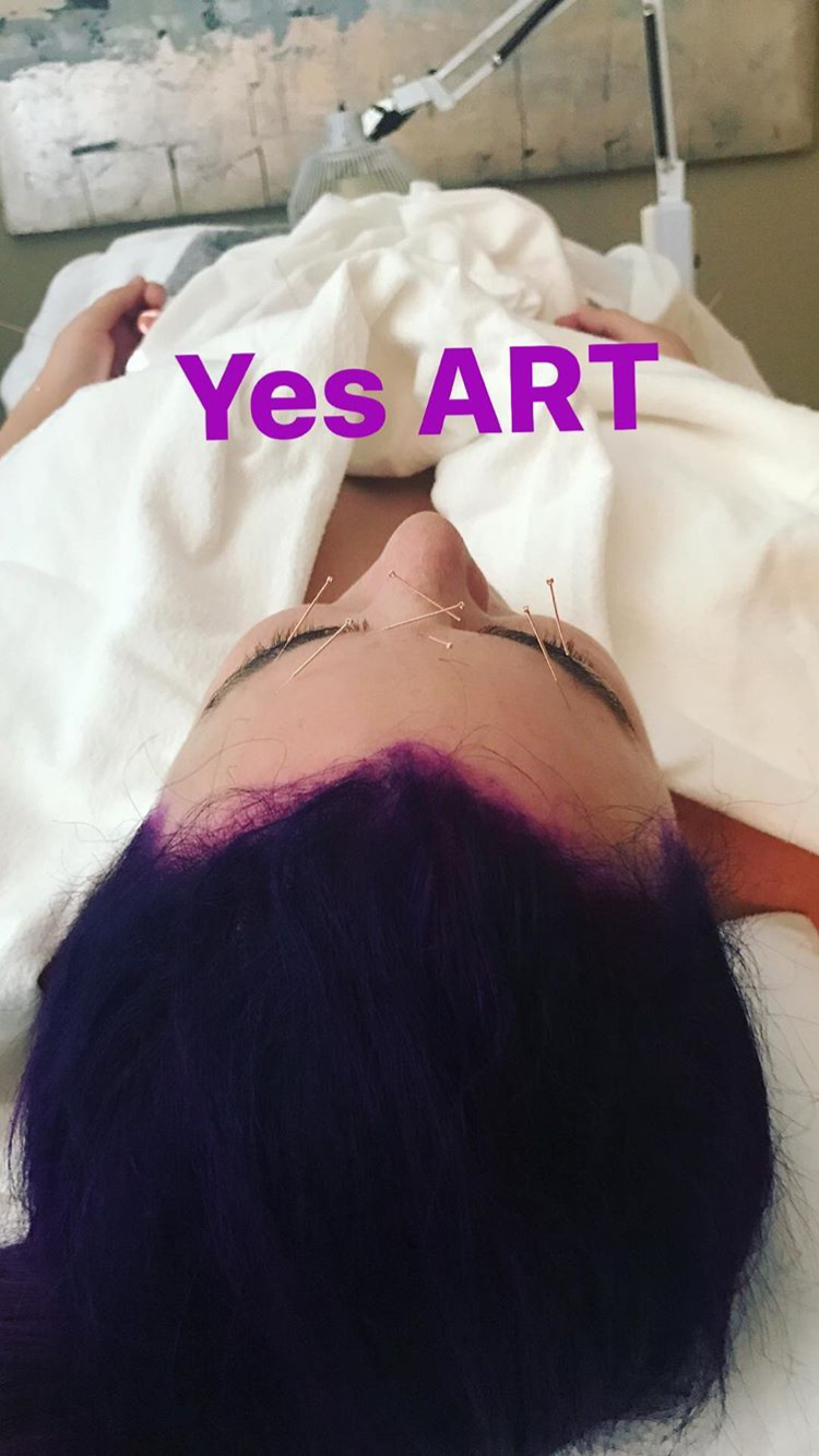 Acupuncture Vancouver - Alla Ozerova - 17.PNG