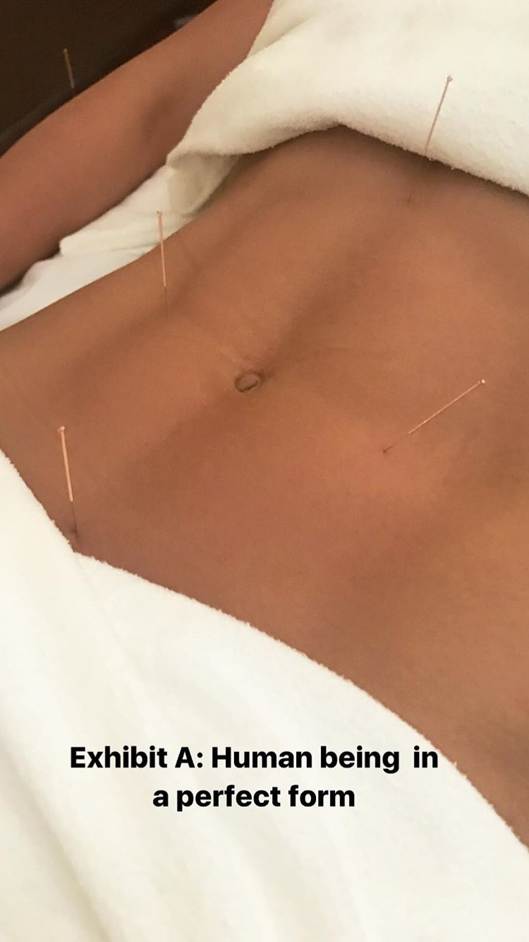 Acupuncture Vancouver - Alla Ozerova - 19.PNG