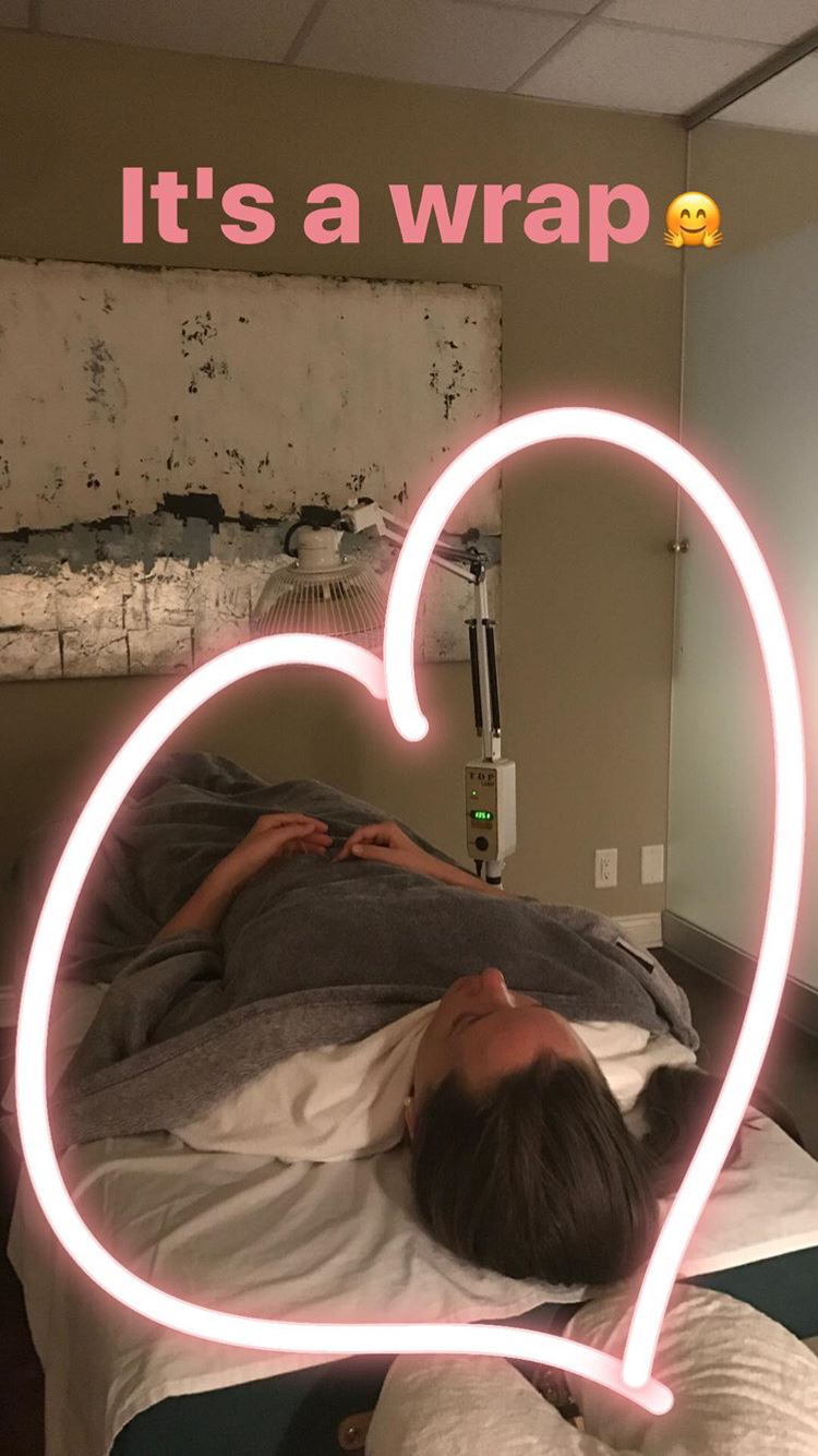 Acupuncture Vancouver - Alla Ozerova - 20.PNG