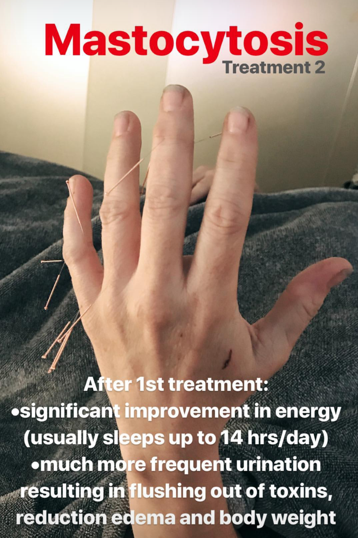  Continuation for autoimmune disorder, multiple sclerosis treatment. Treatment lead to frequent urination, increase in regular sleeping schedules as well as a decrease in body weight 