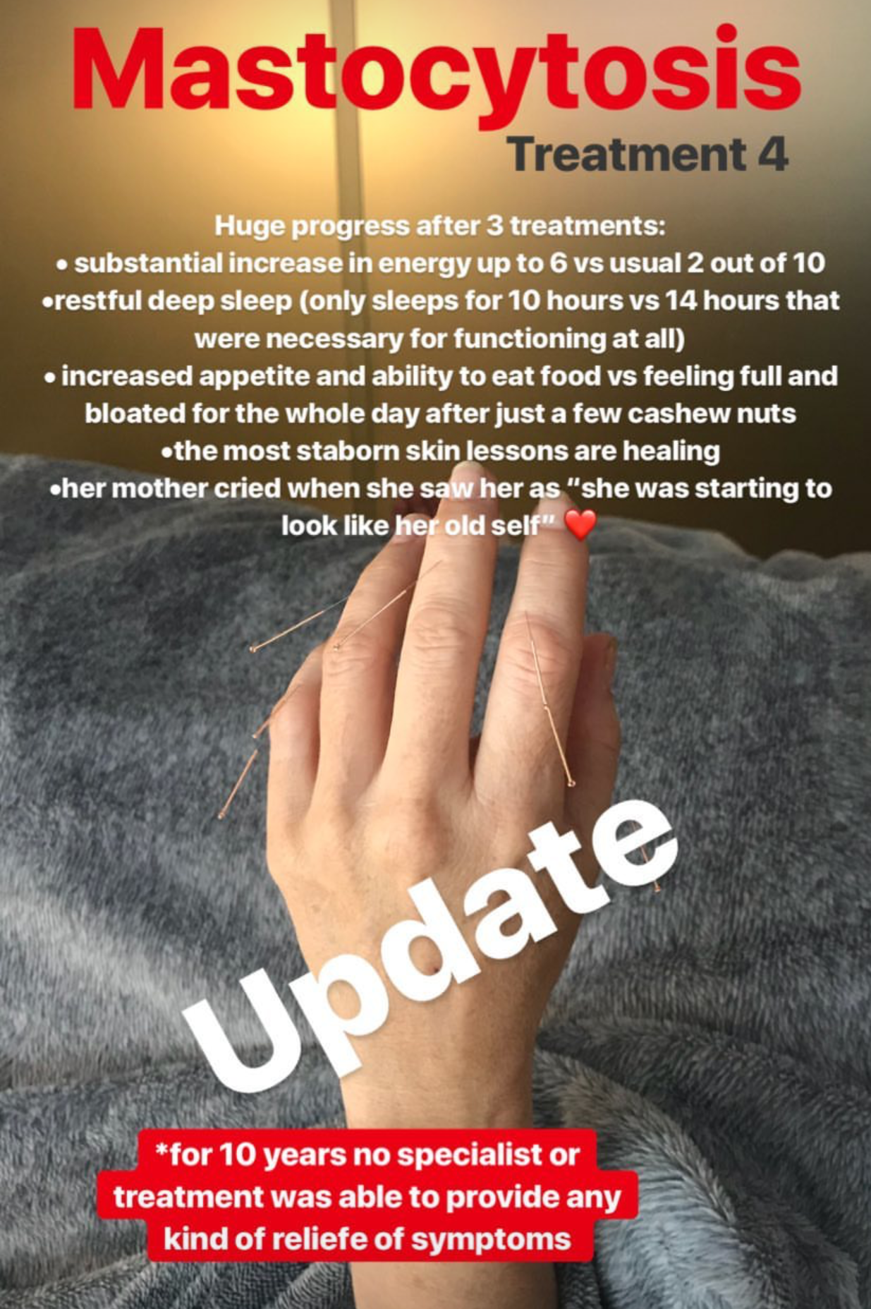  Continuation for autoimmune disease, Mastocytosis. Treatment lead to an increased appetite and decrease in bloating as well as a substantial increase in energy. 