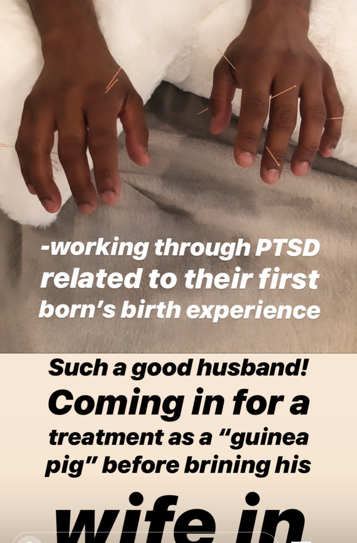  SuJok acupuncture treatment used as couples therapy to work through Post Traumatic Stress Disorder (PTSD) triggered by important life events such as the birth of a child.  