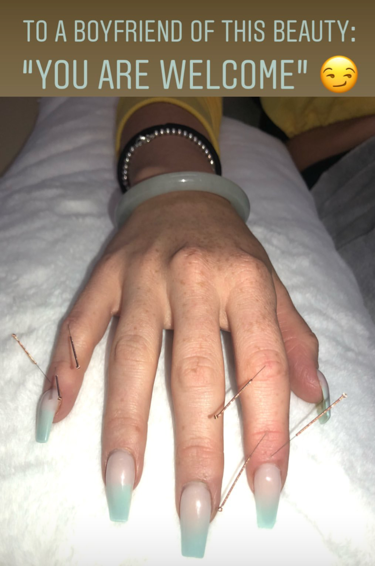  SuJok Acupuncture treatment used as an alternative to couples therapy and aiding in individual stability. 