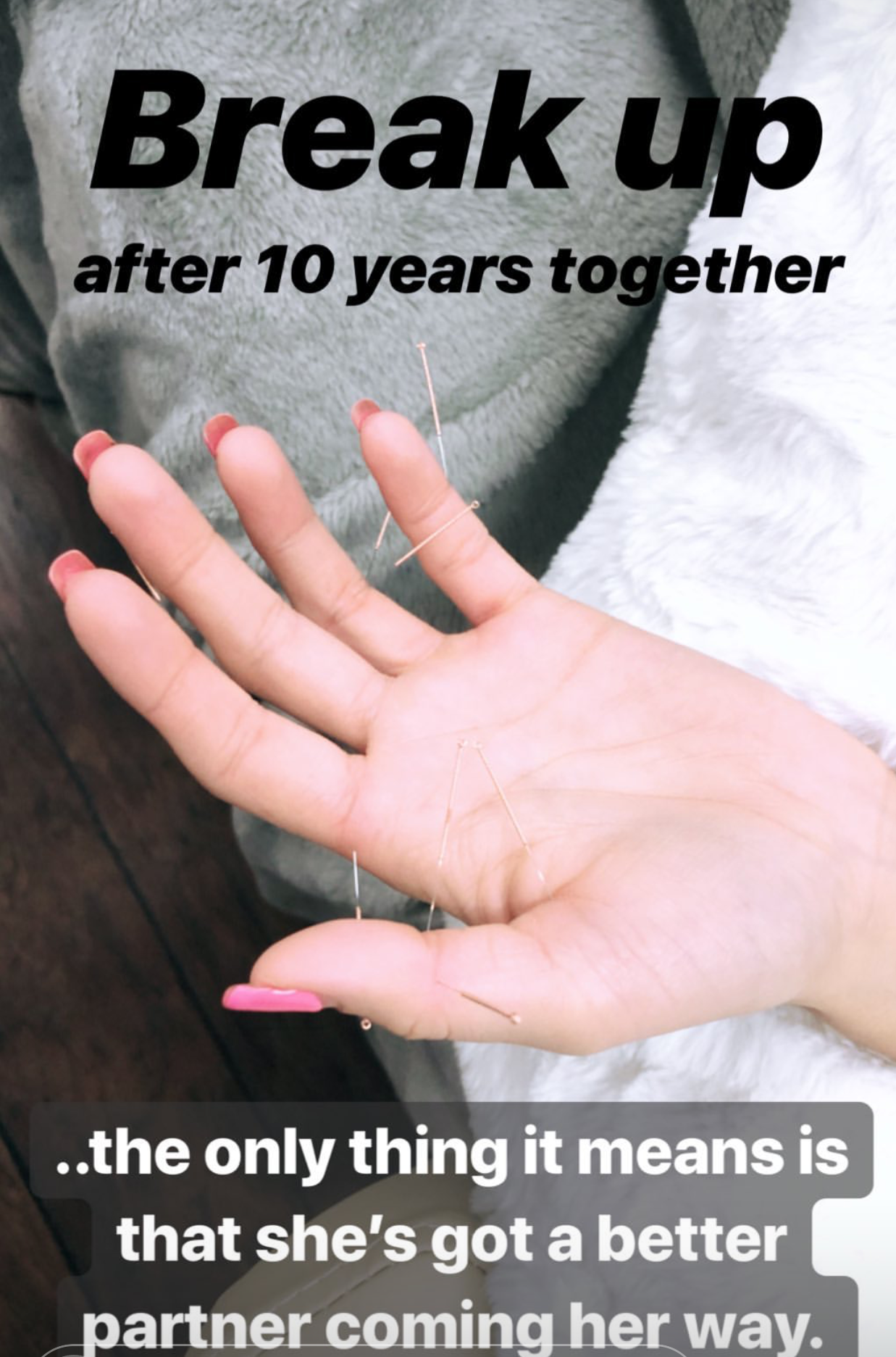  Sujok acupuncture treatment used for couples therapy, often times to work through unstable relationships ending up in breakup after longer relationship years  