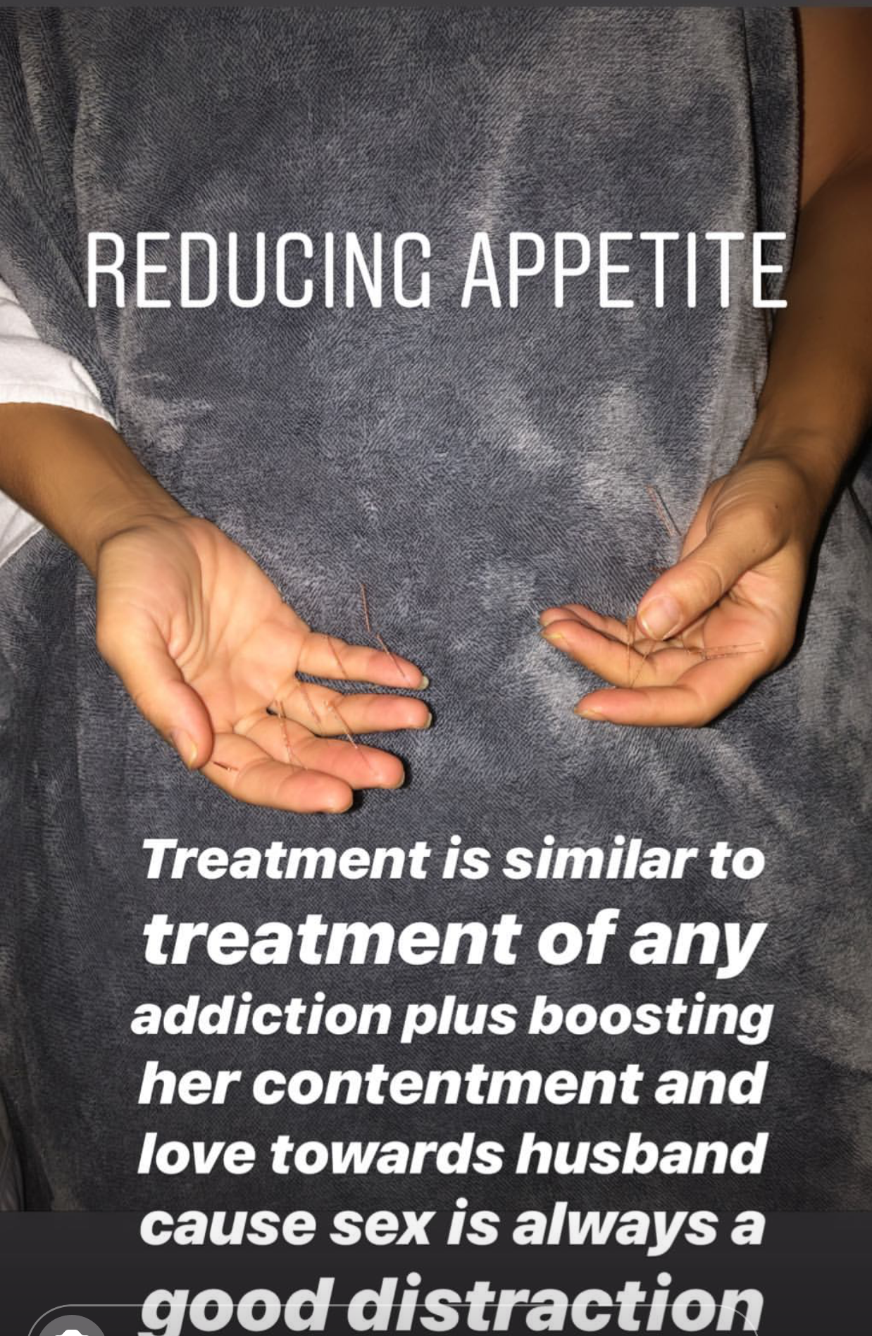  SuJok acupuncture treatment used for common digestive-related conditions and addictions.  Treatment was intended to reduce appetite through formulas used on common addictions, as well as a boost in relationship life 