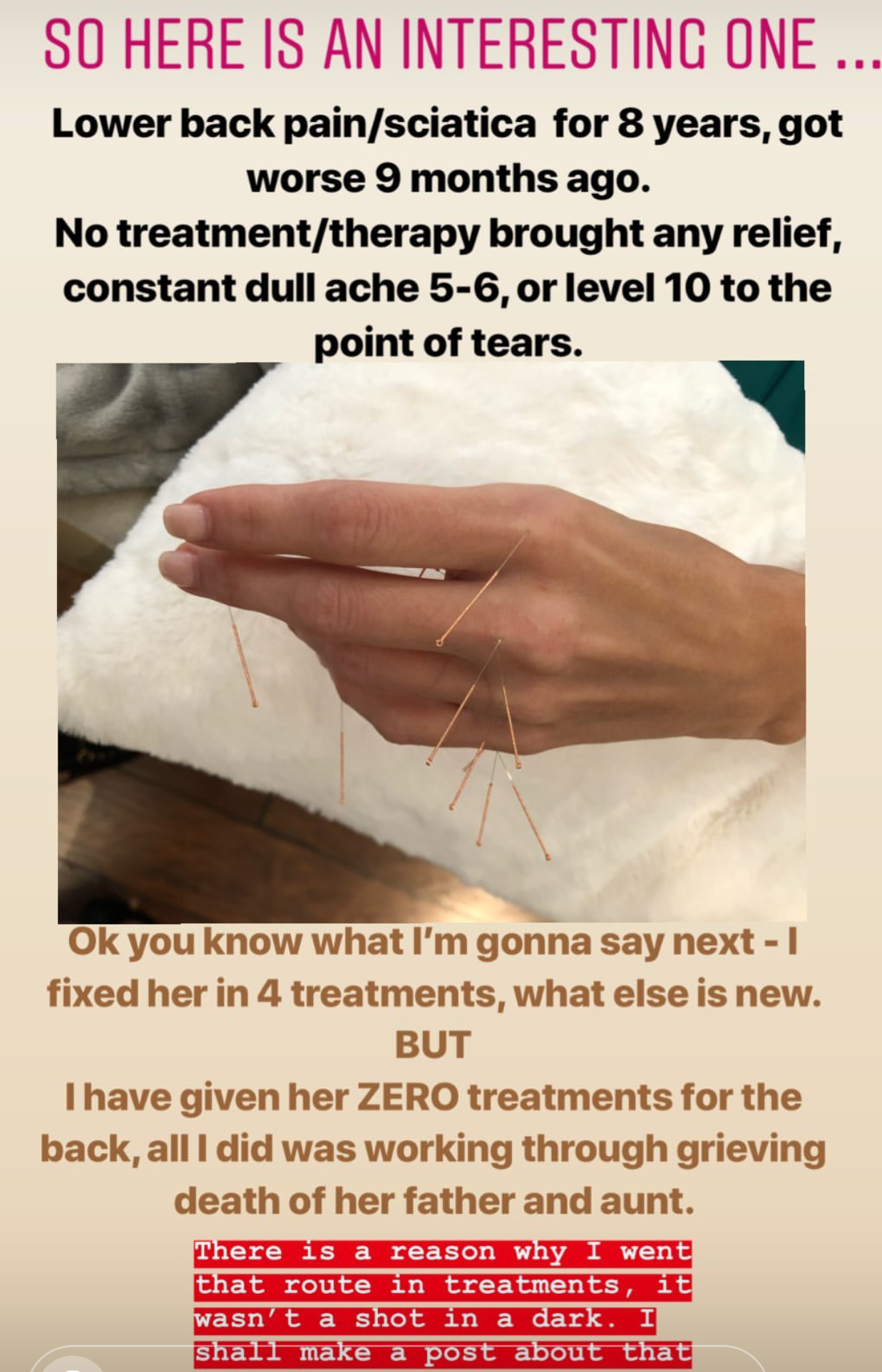  SuJok acupuncture treatment in Vancouver used for patients with pain syndrome, in this case: patient with lower back pain caused by the sciatica nerve. Treatment resulted in the successful reduction of severe pain through working the emotional roots