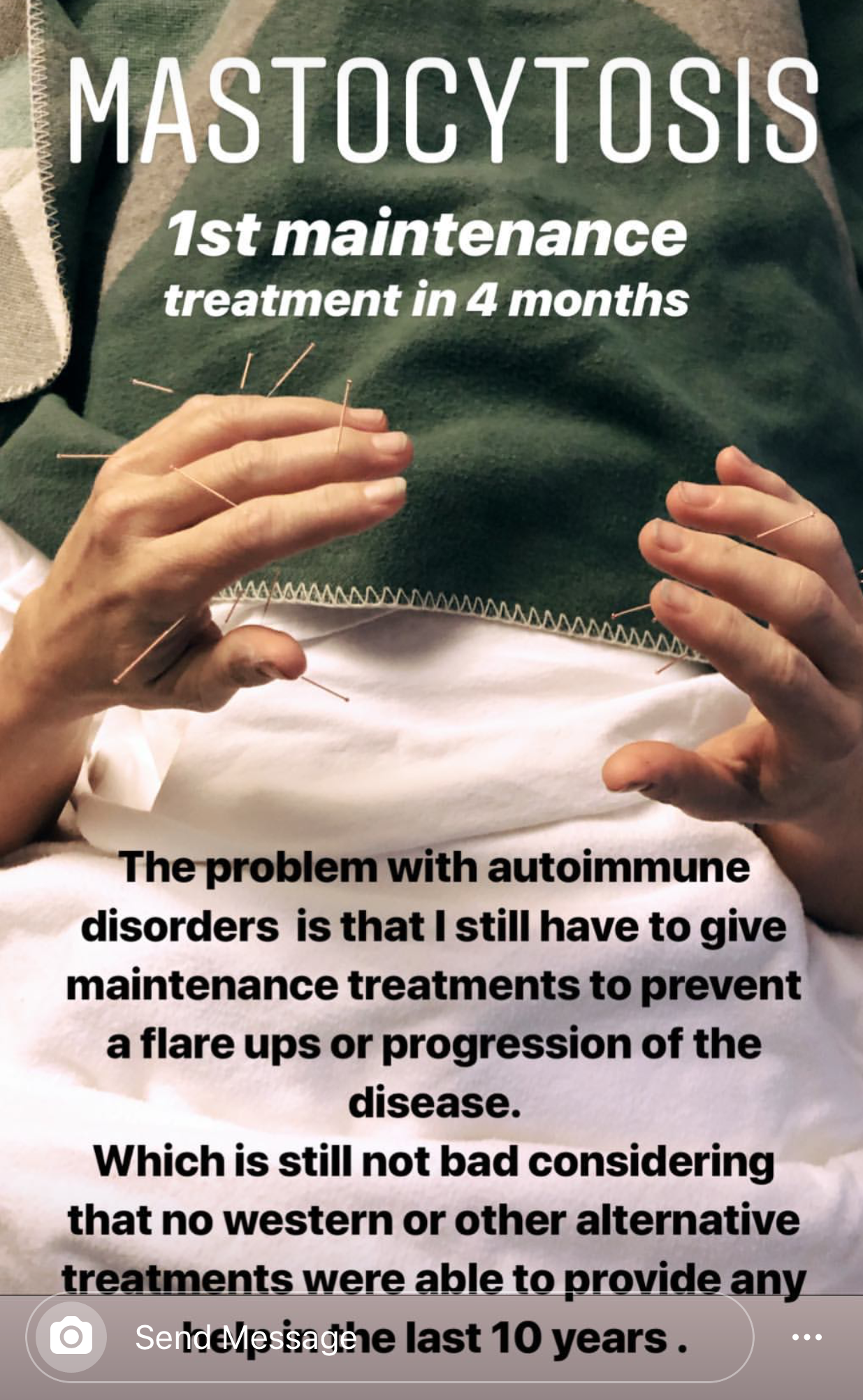  SuJok acupuncture in Vancouver used as an alternative for patient’ts with rare autoimmune disease, Mastocytosis. Patient was successfully treated for rare symptoms associated with the disease. 