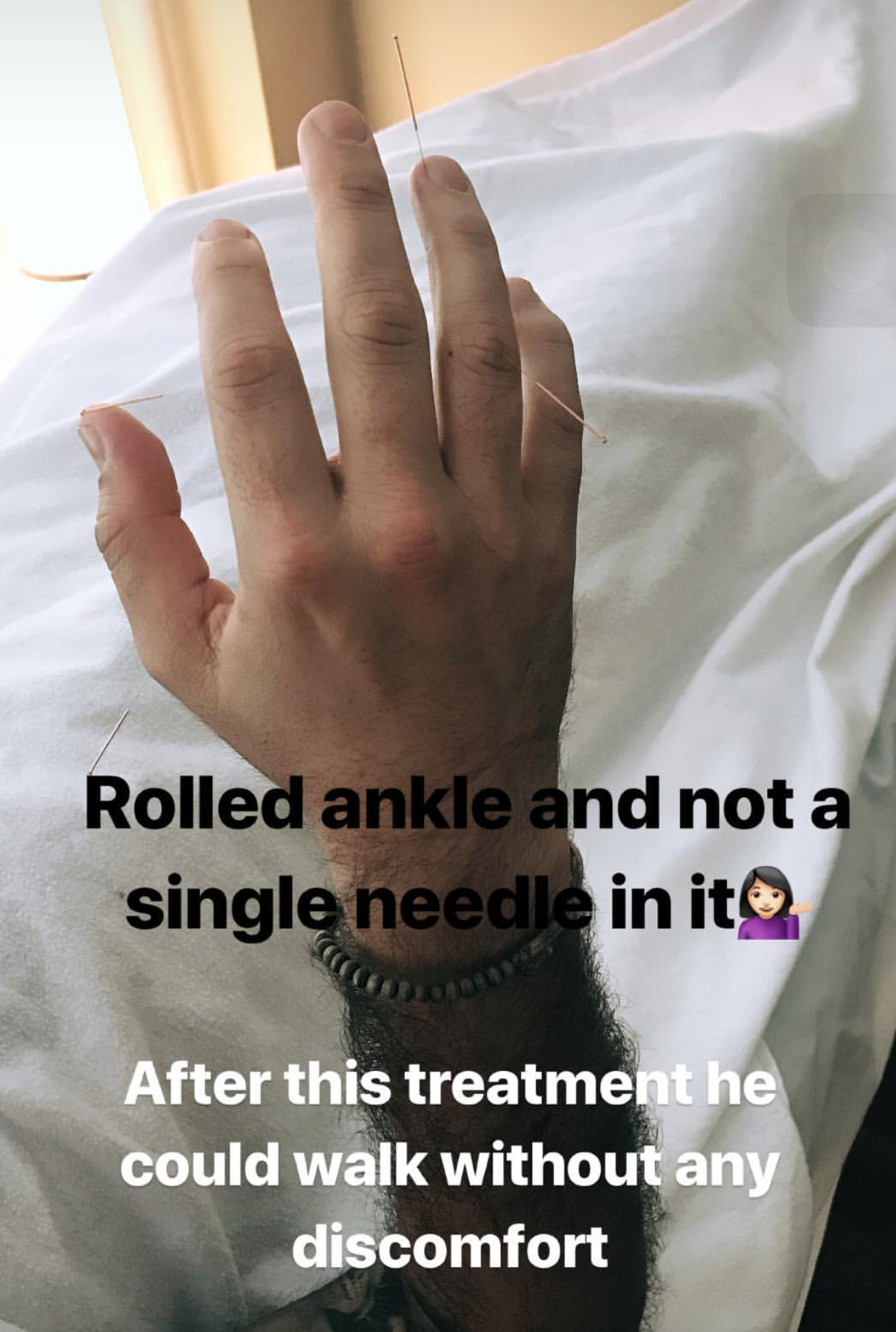  SuJok acupuncture treatment based in Vancouver used to treat patients with sports injuries. Patient had a rolled ankle and could not walk. Treatment resulted in reduction of pain and ability to walk without discomfort.  