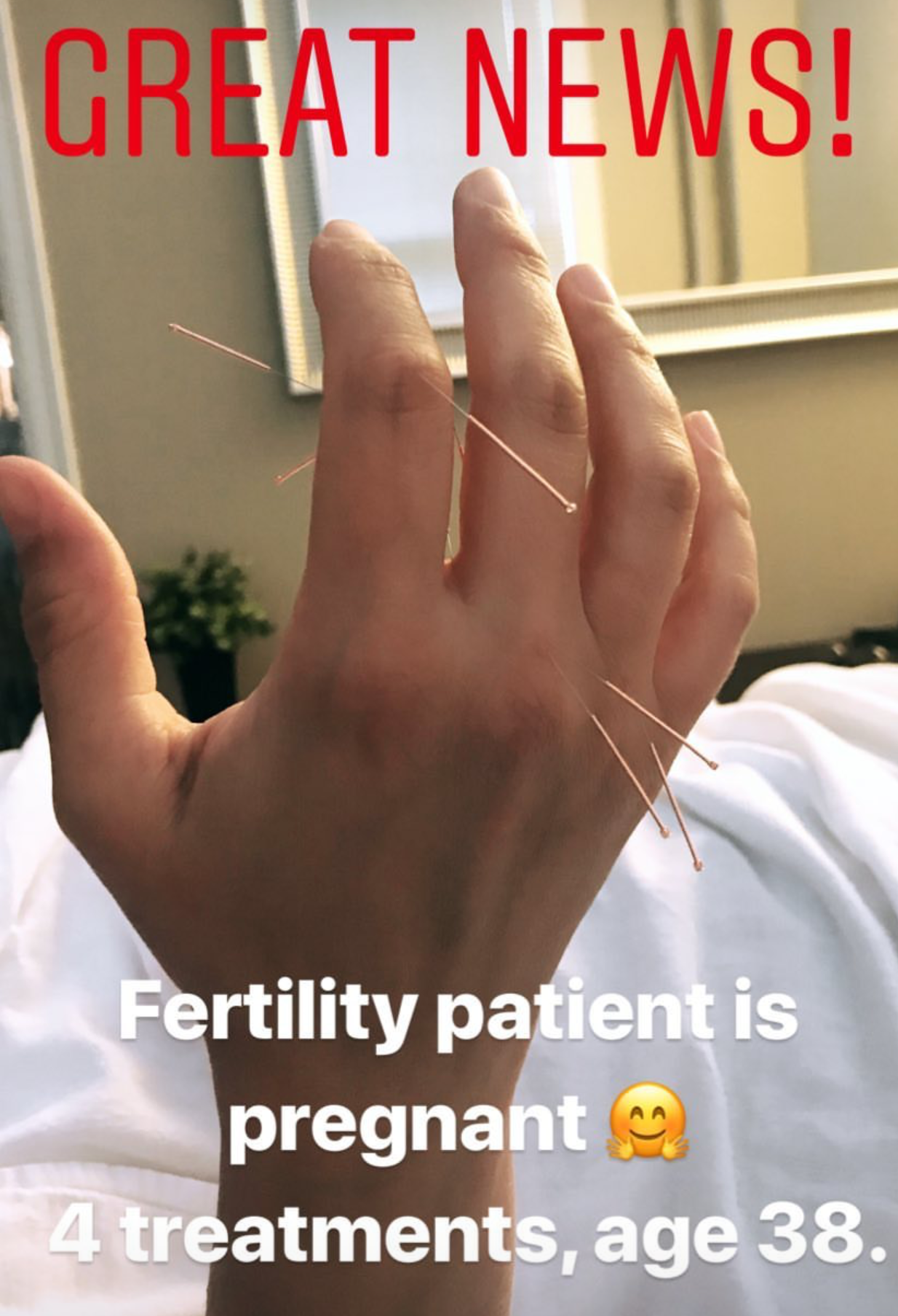  SuJok acupuncture in Vancouver used for fertility and reproductive health treatments. Patient in for fourth treatment is pregnant 