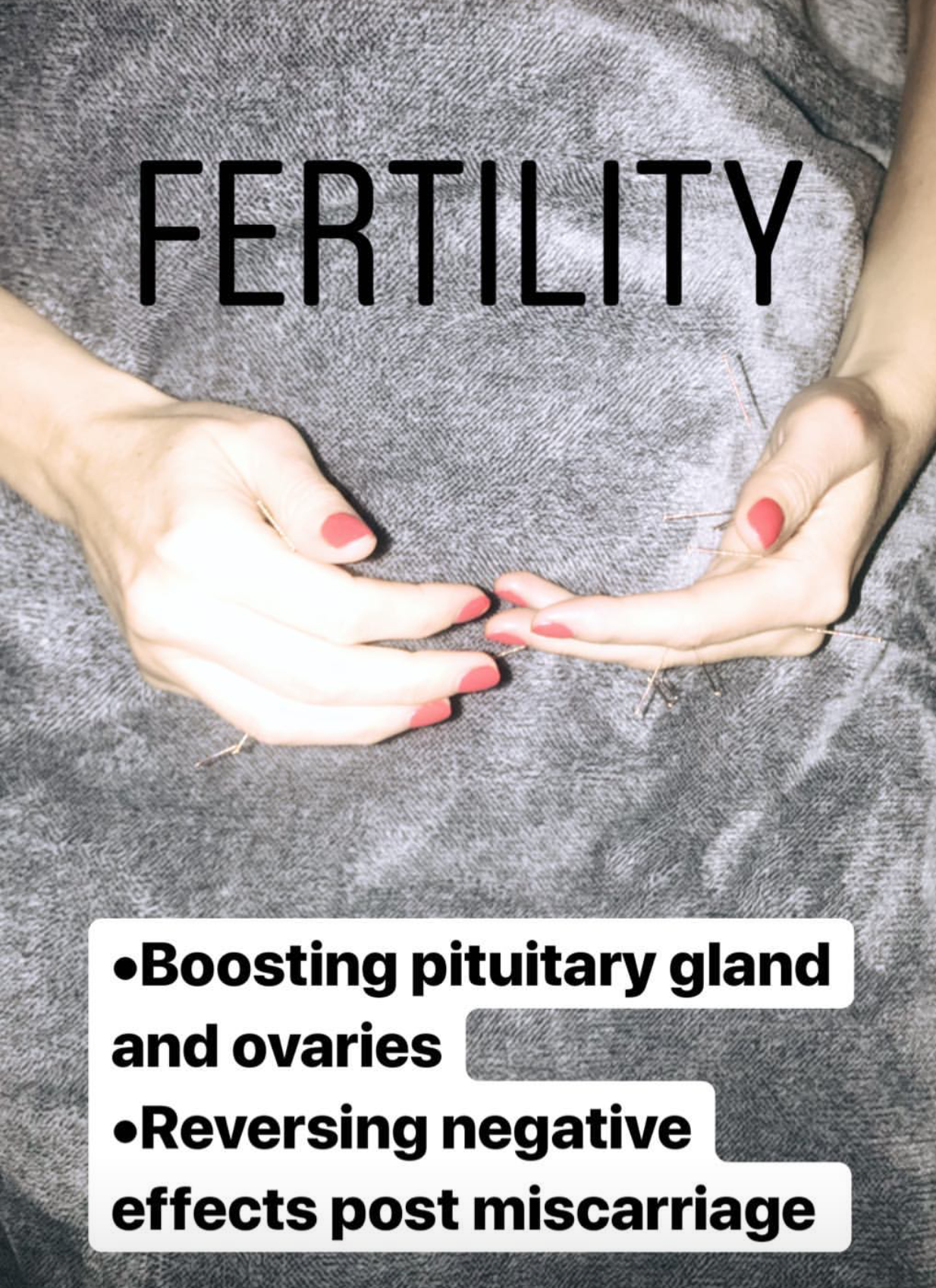  SuJok acupuncture treatments based in Vancouver used for fertility and reproductive health. Patient was treated to boost pituitary gland and ovaries, as well as reversing emotional effects of post-miscarriage  