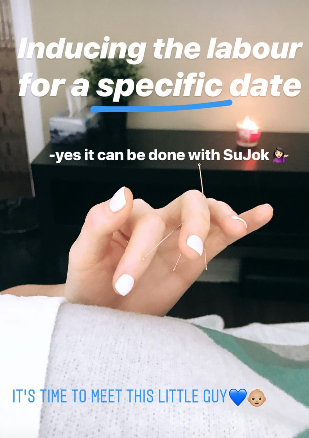  SuJok acupuncture in Vancouver used to treat fertility and reproductive health. Patient receives treatment for specific date labor induction 