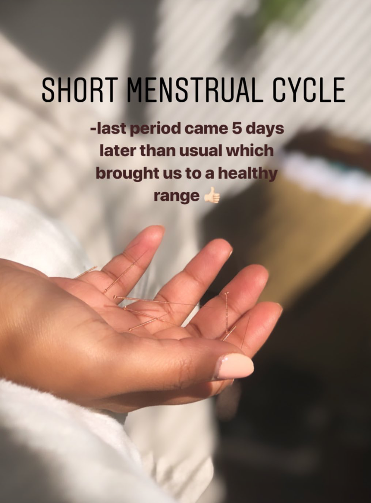  SuJok acupuncture in Vancouver used for treating reproductive system conditions. Patient receives treatment for short-length period cycles. Treatment resulted in the successful delay and promotion of regular period cycle.  