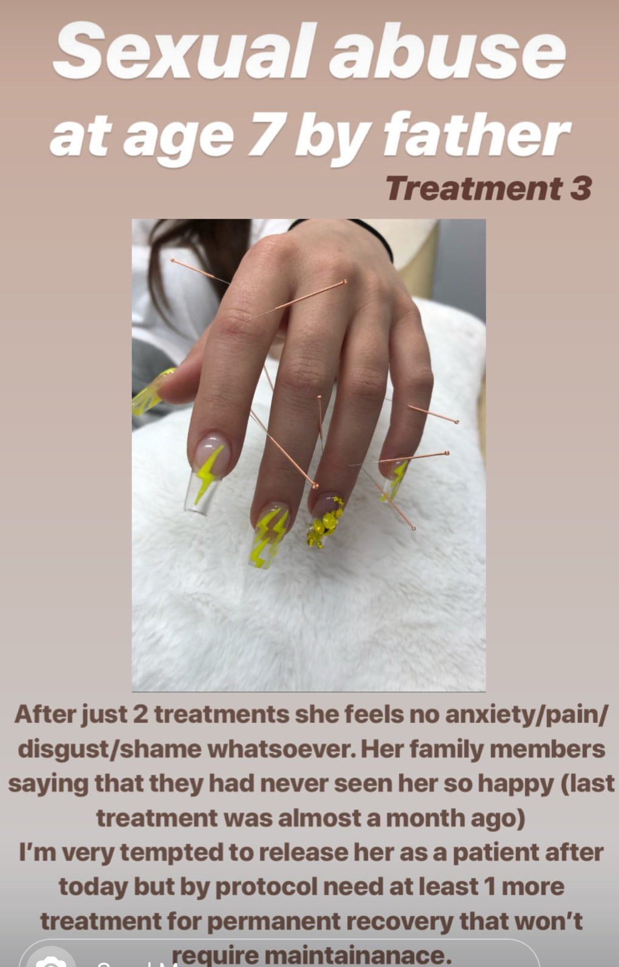  SuJok acupuncture in Vancouver used for treating mental health. Patient received treatment for going through sexual abuse, in this case she was raped by her father at age 7. Third treatment involved continuation of growth and overcoming anxiety and 