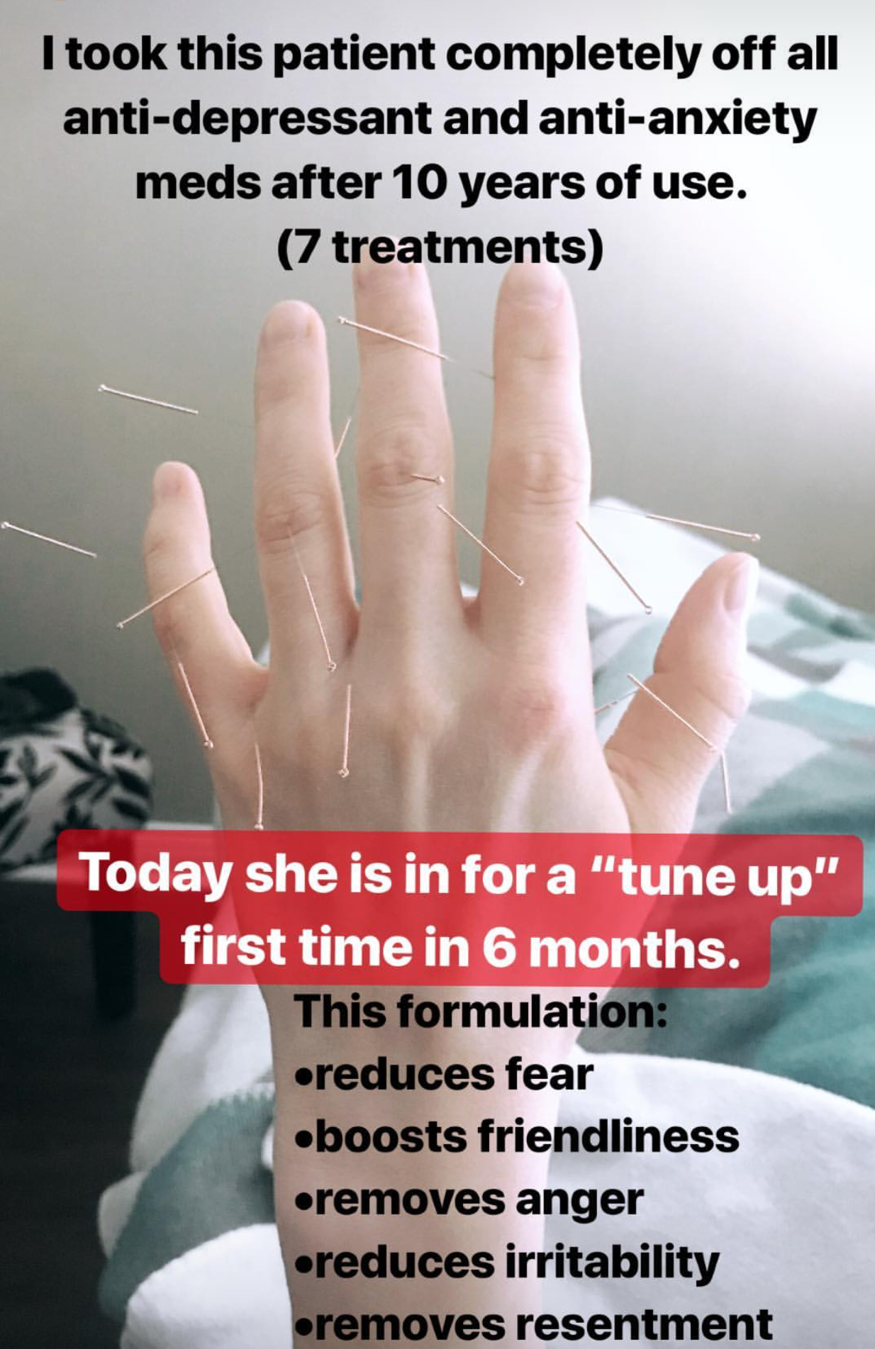  SuJok acupuncture in Vancouver used for treating mental health. Patient received treatment for being on antidepressants for 10 years. Treatment number seven served as a “tune up” for boosting friendliness, removing anger and resentment, etc.  