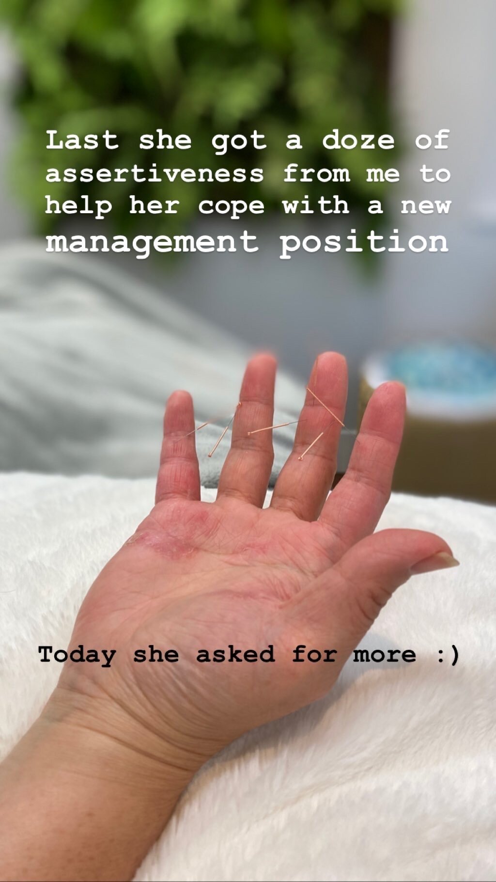  SuJok acupuncture in Vancouver used as treatment in career and personal life. Patient received treatment for emotional aid in a new management position 