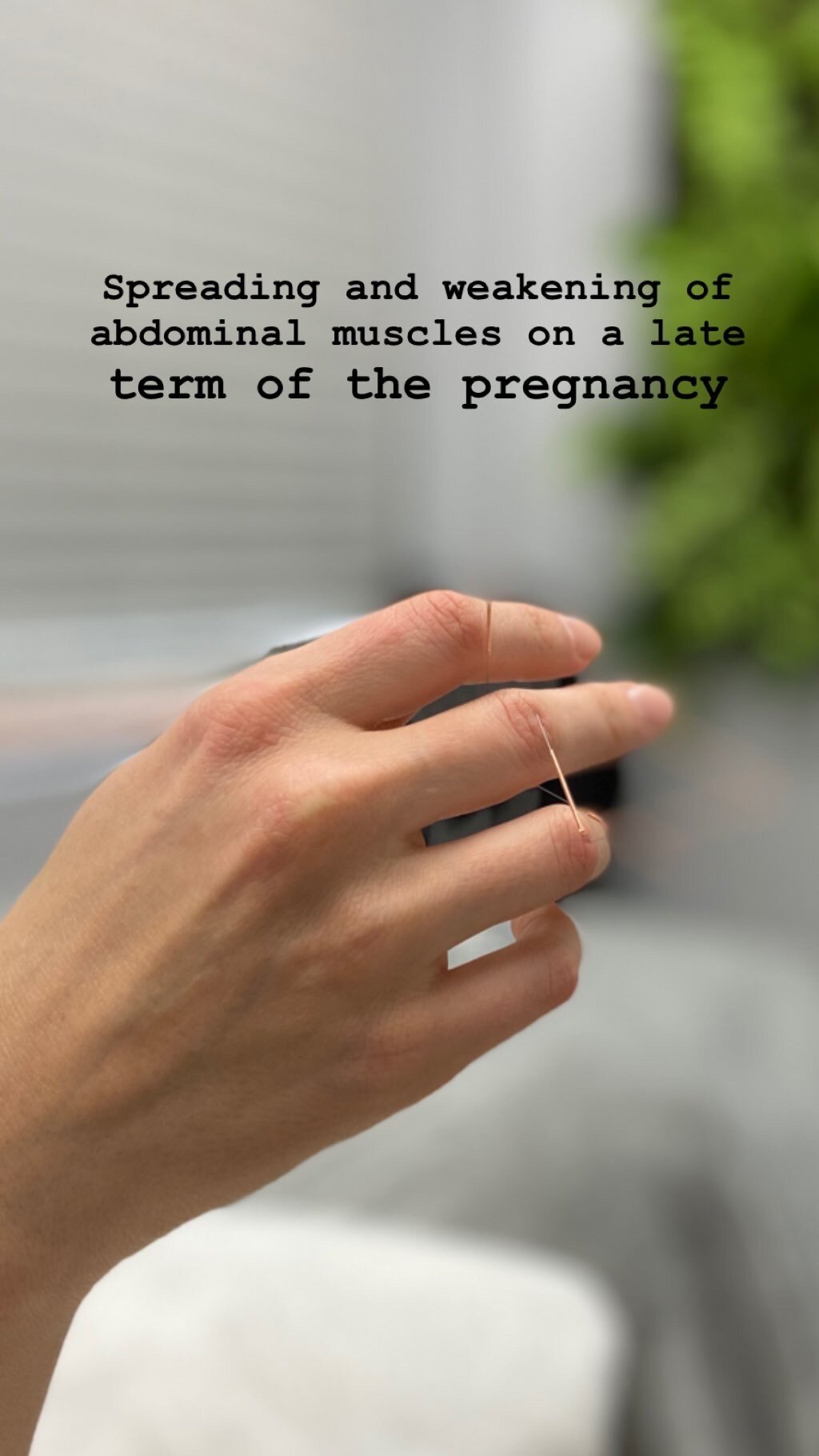  SuJok acupuncture in Vancouver used to treat fertility and reproductive health. Patient received treatment for the weakening of abdominal muscles during late term pregnancy 