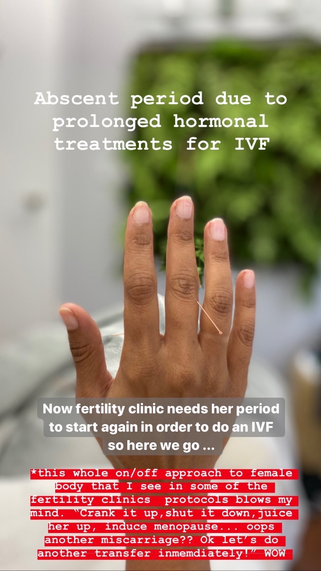  SuJok acupuncture in Vancouver used as alternative treatment for reproductive system issues and conditions. Patient received treatment for absent menstruation due to hormonal treatments for In VItro Fertilization IVF.  