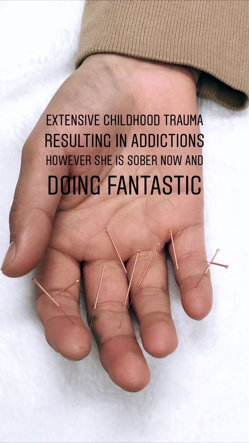  SuJok acupuncture in Vancouver used to treat mental health. Patient received treatment for extensive childhood trauma resulting in addiction. Treatment was successful in keeping sobriety and boosting personal life.  