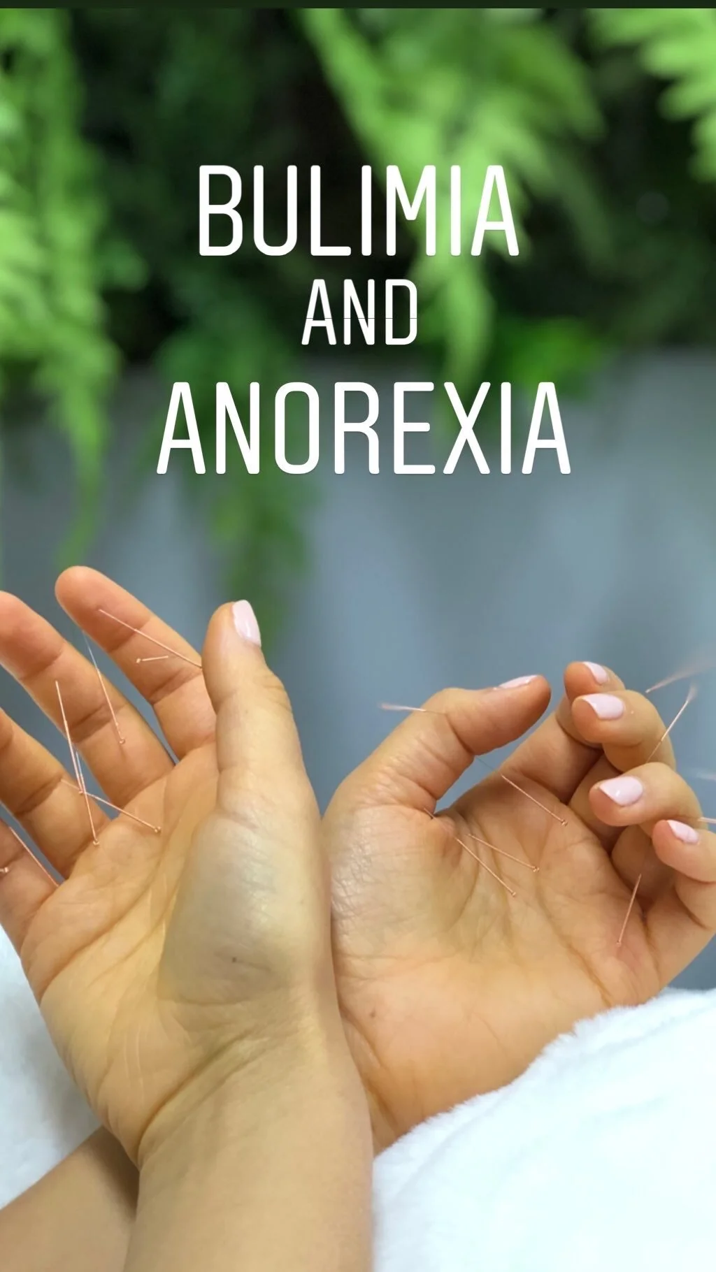  SuJok acupuncture in Vancouver used as treatment for eating disorders. Patient received treatment for Anorexia and Bulimia 