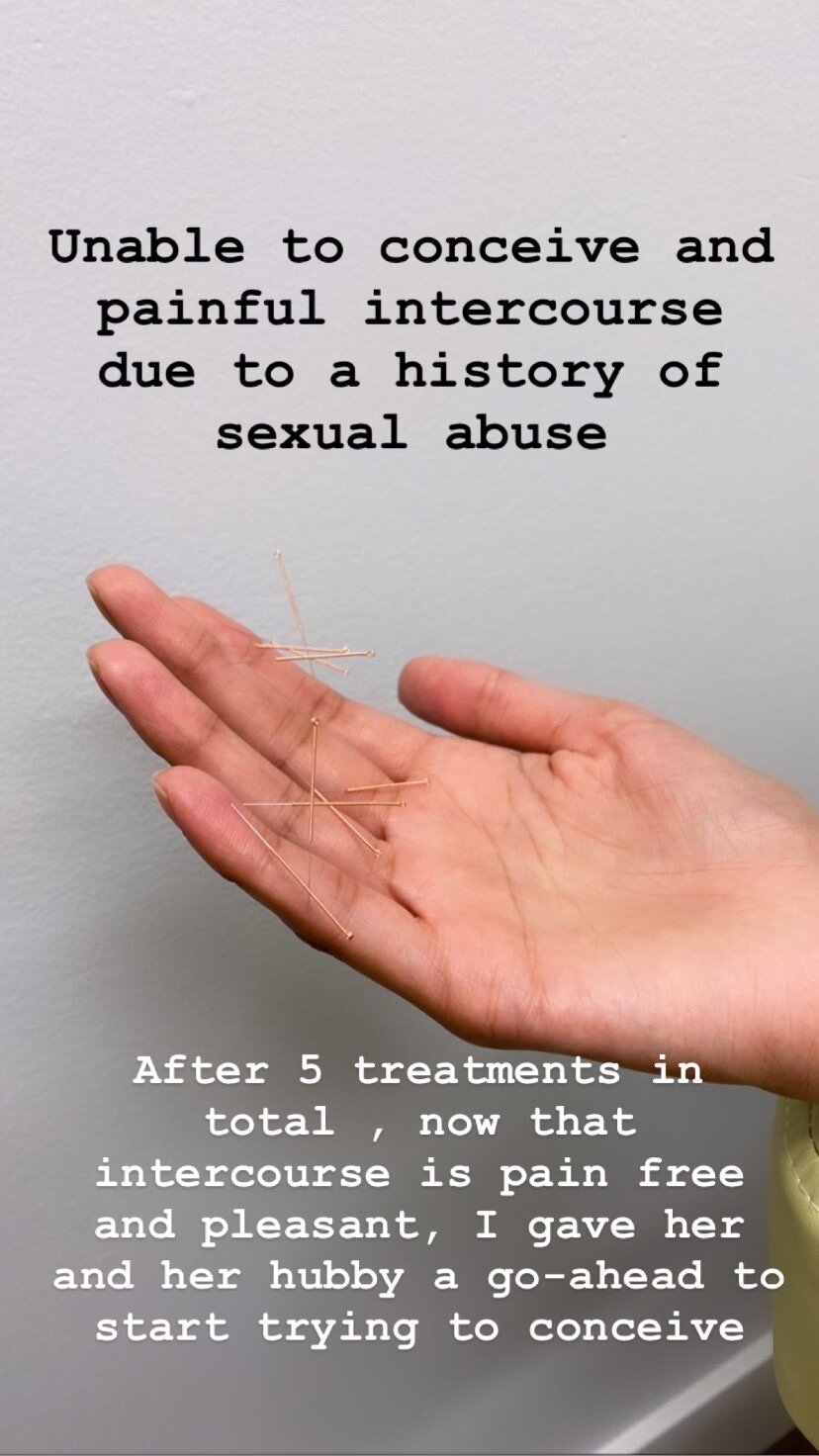  Sujok acupuncture based in Vancouver at alla ozerova acupuncture clinic used to treat fertility and reproductive health. Patient had painful intercourse and was unable to conceive. After five treatments patient no longer feel pain during intercourse