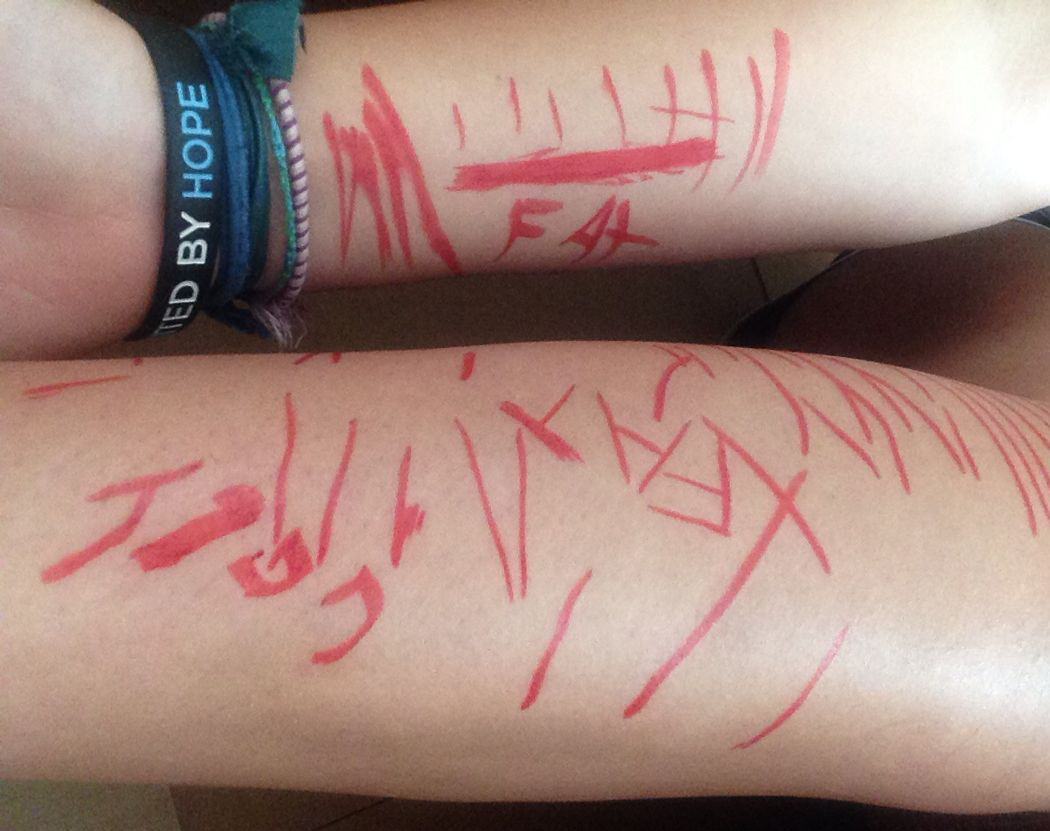 Cutting & Self Harm - Limitless