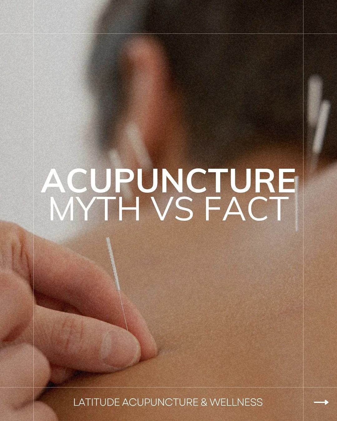 Yes, acupuncture isn&rsquo;t just for pain relief! Acupuncture treatments can support your overall health and wellbeing, including your sleep, stress, digestion, and overall health and balance.

#acupuncturefacts #acupuncture #latitudeacupunctureandw