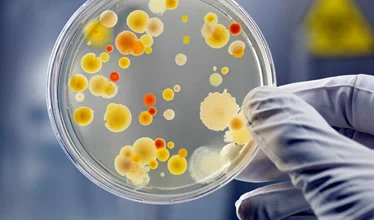 ….Jakkes microben ..Ugh microbes ….