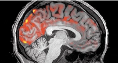 ....De ultieme hersenspoeler..The ultimate brainwasher....