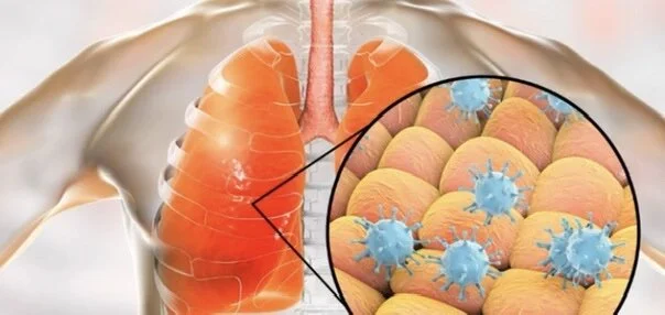 ....Beslissingen en COVID-19..Decisions and COVID-19....