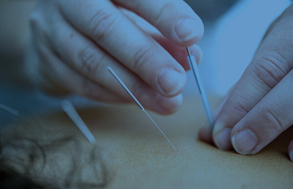 Medicare Covered Acupuncture Services