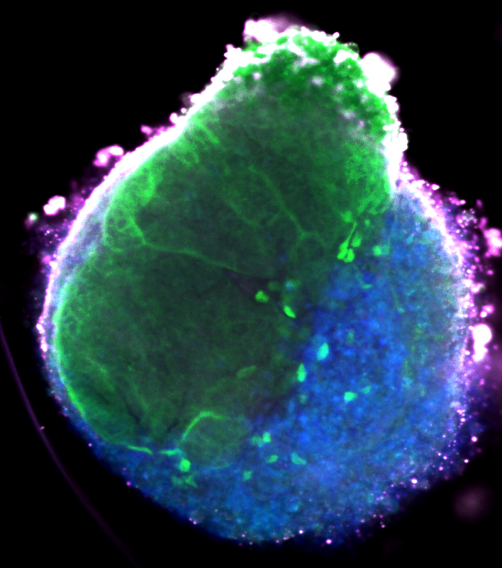 March3_organoid.png