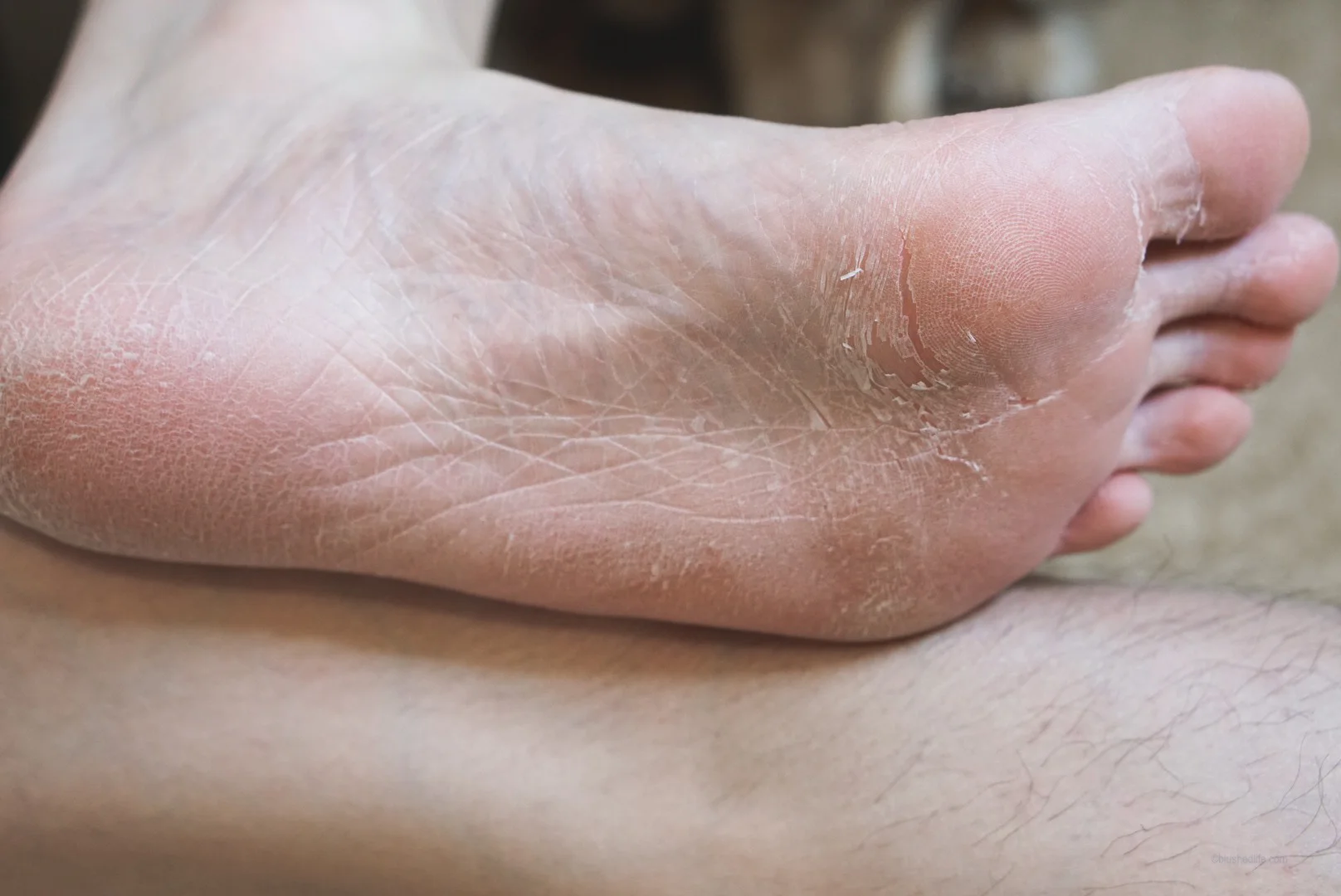 Get Rid of Cracked Feet + Heels The Face Shop Smile Foot Peeling Mask