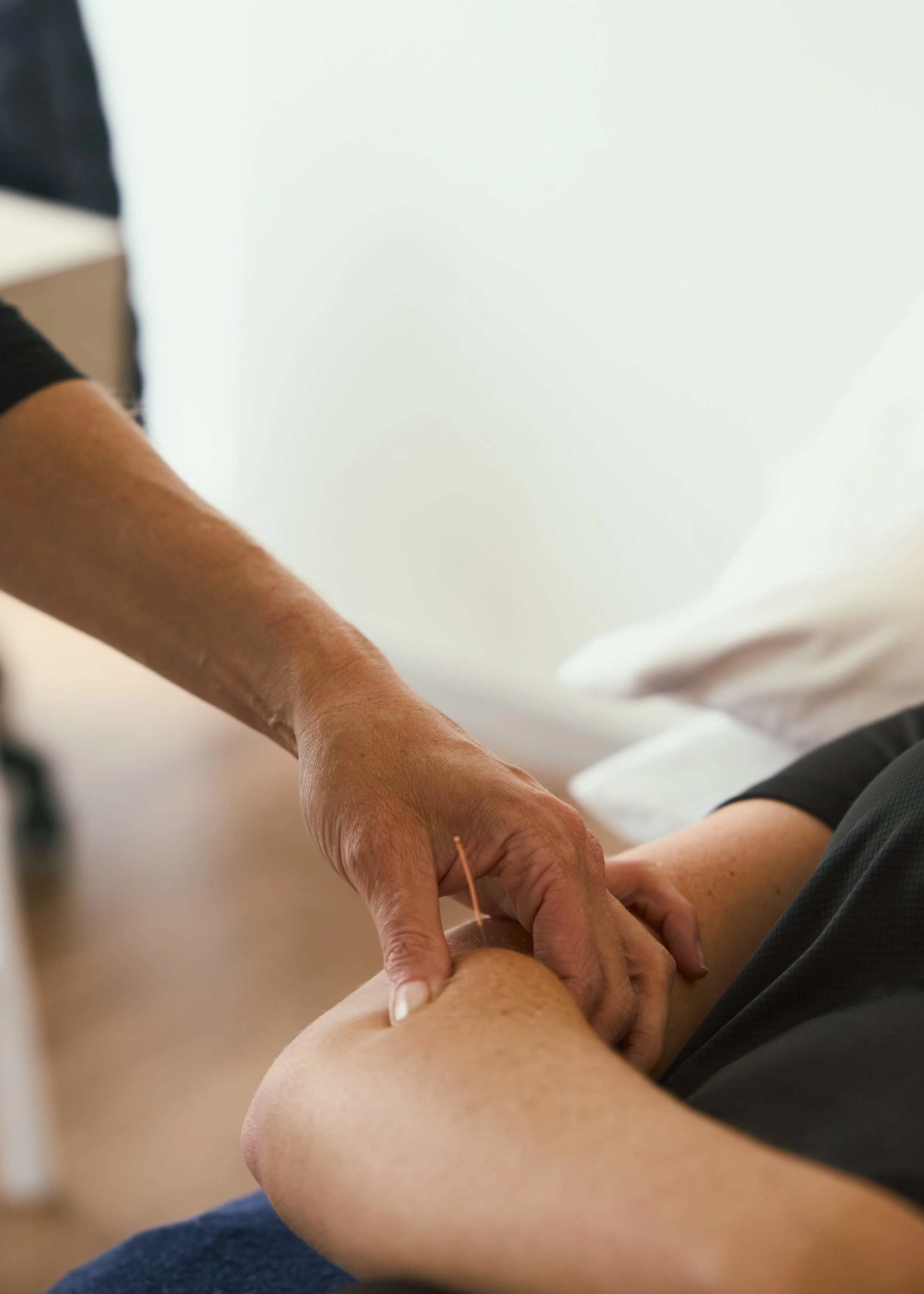 DRY NEEDLING