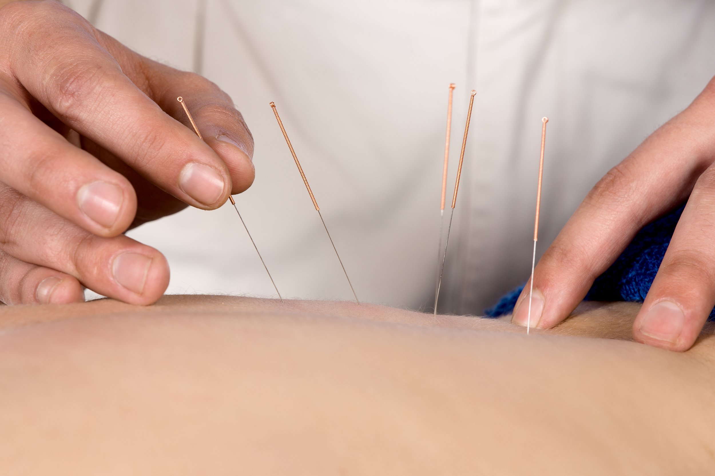 Pro Health Therapy Rooms fertility acupuncture.jpg