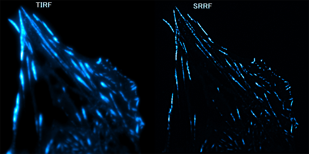 Looking at the movement of cells