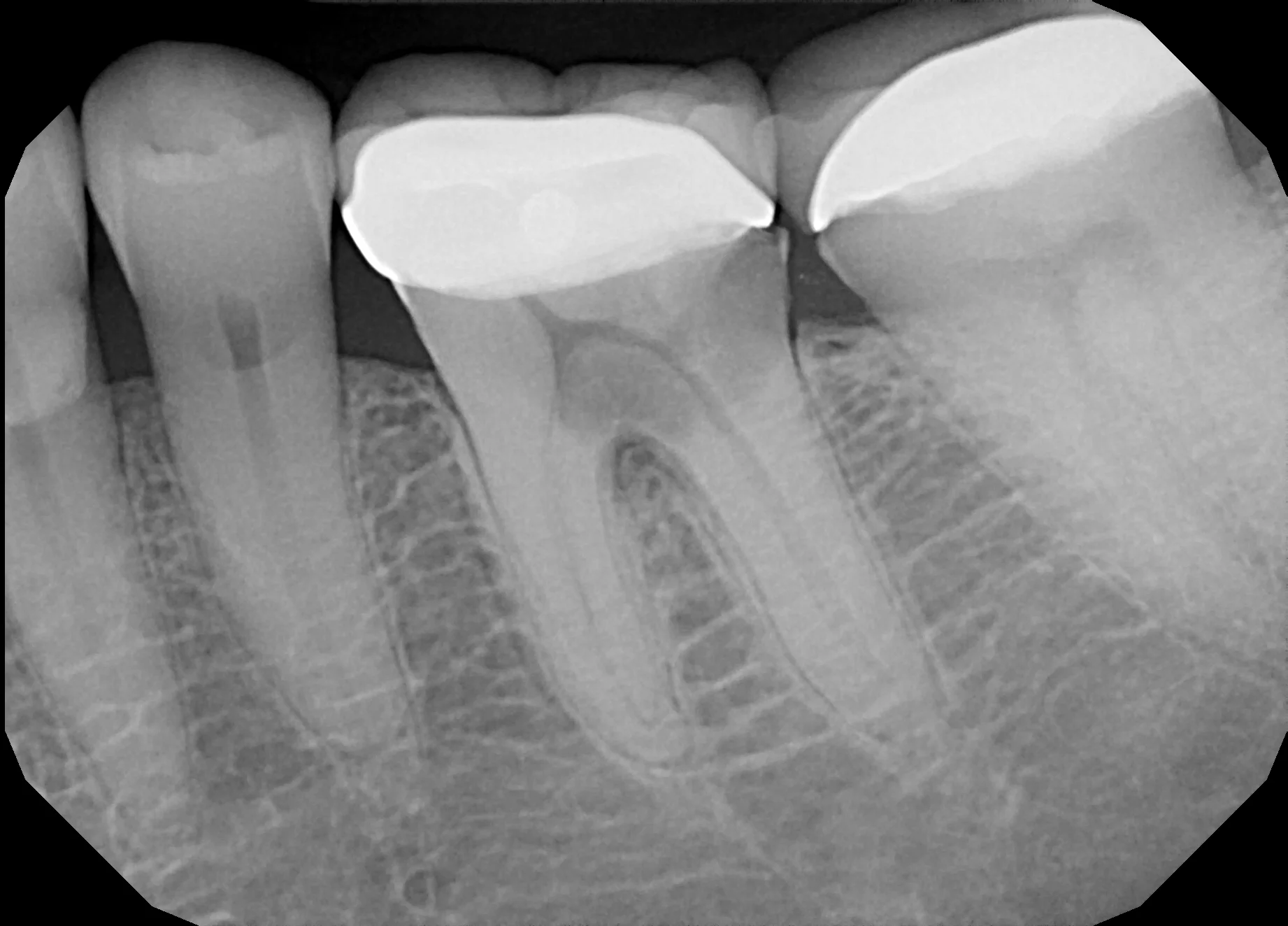 XrayUpload_Upload.JPG