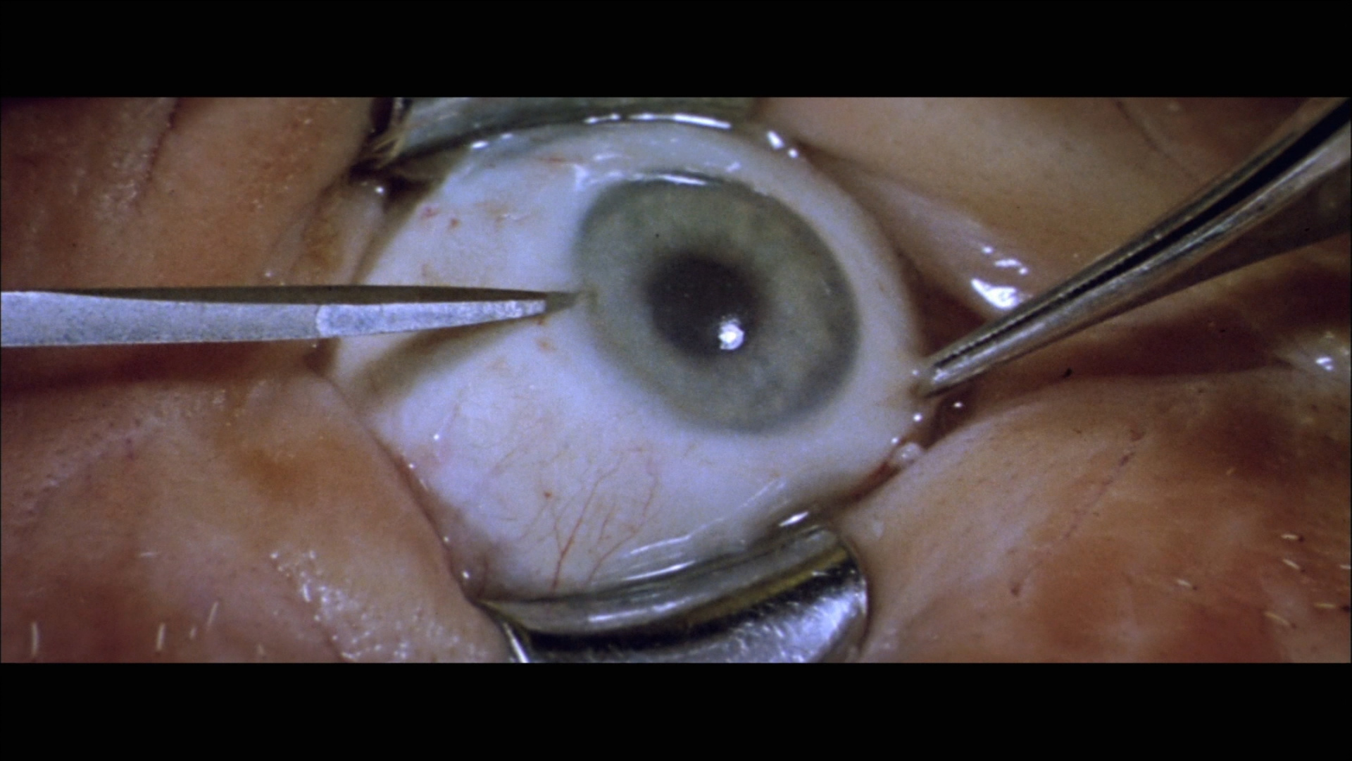 Anguish - 1987