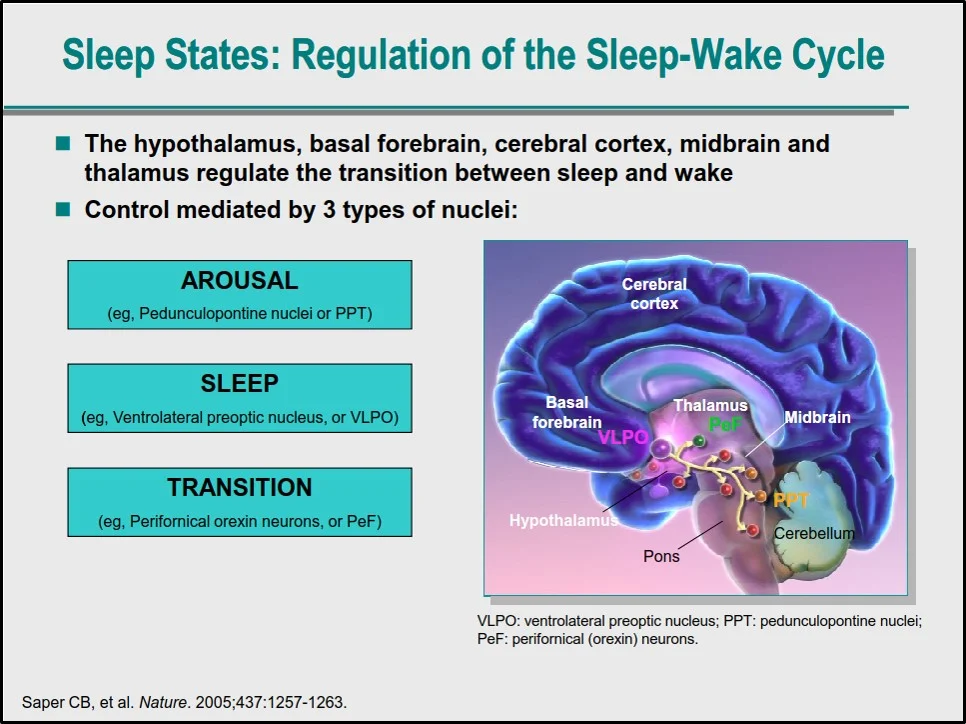 Slide Deck Example / Insomnia